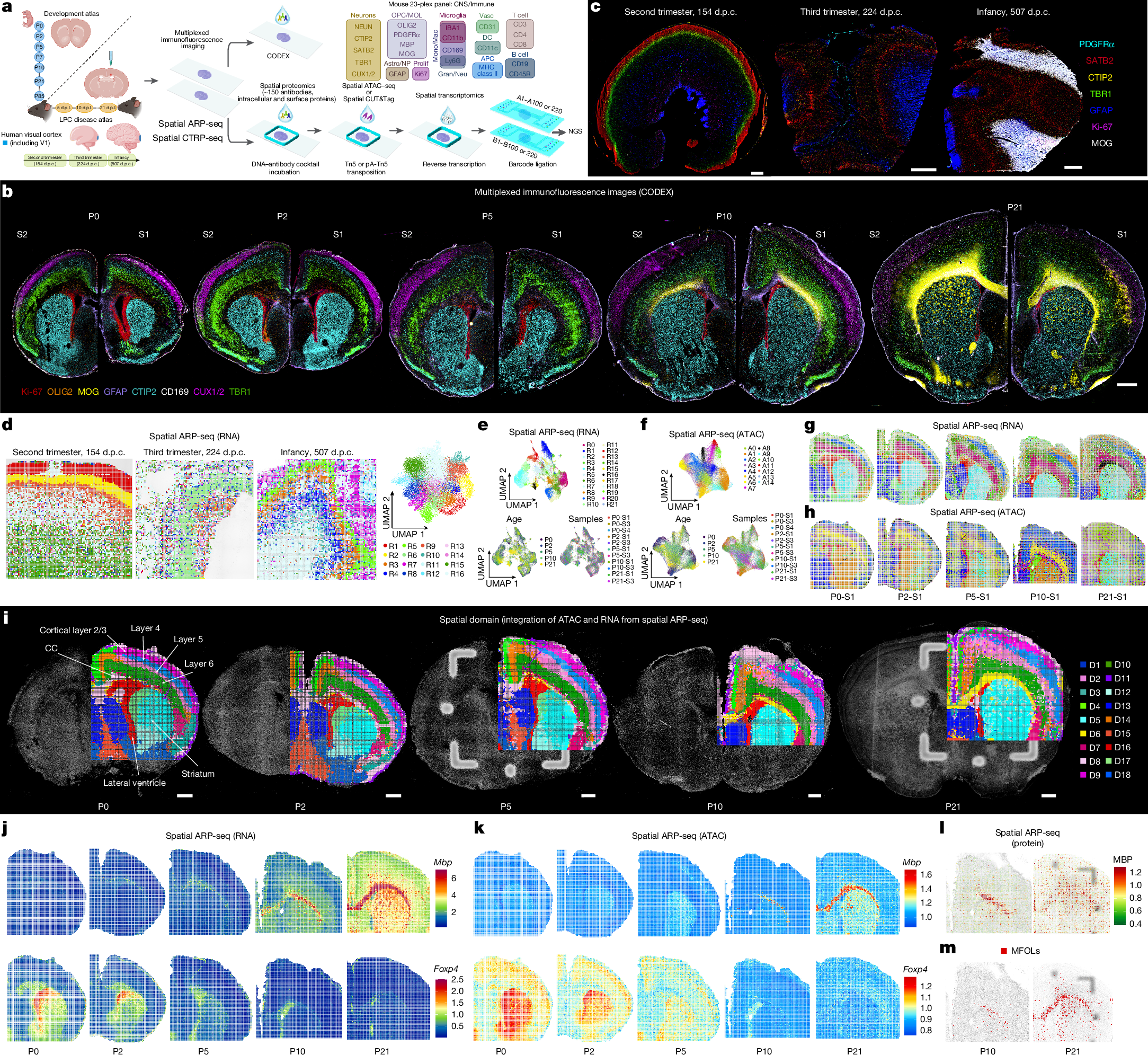 脳の発達と炎症解決過程をマルチマップで解明(Scientists Map How the Brain Develops and Resolves Inflammation)