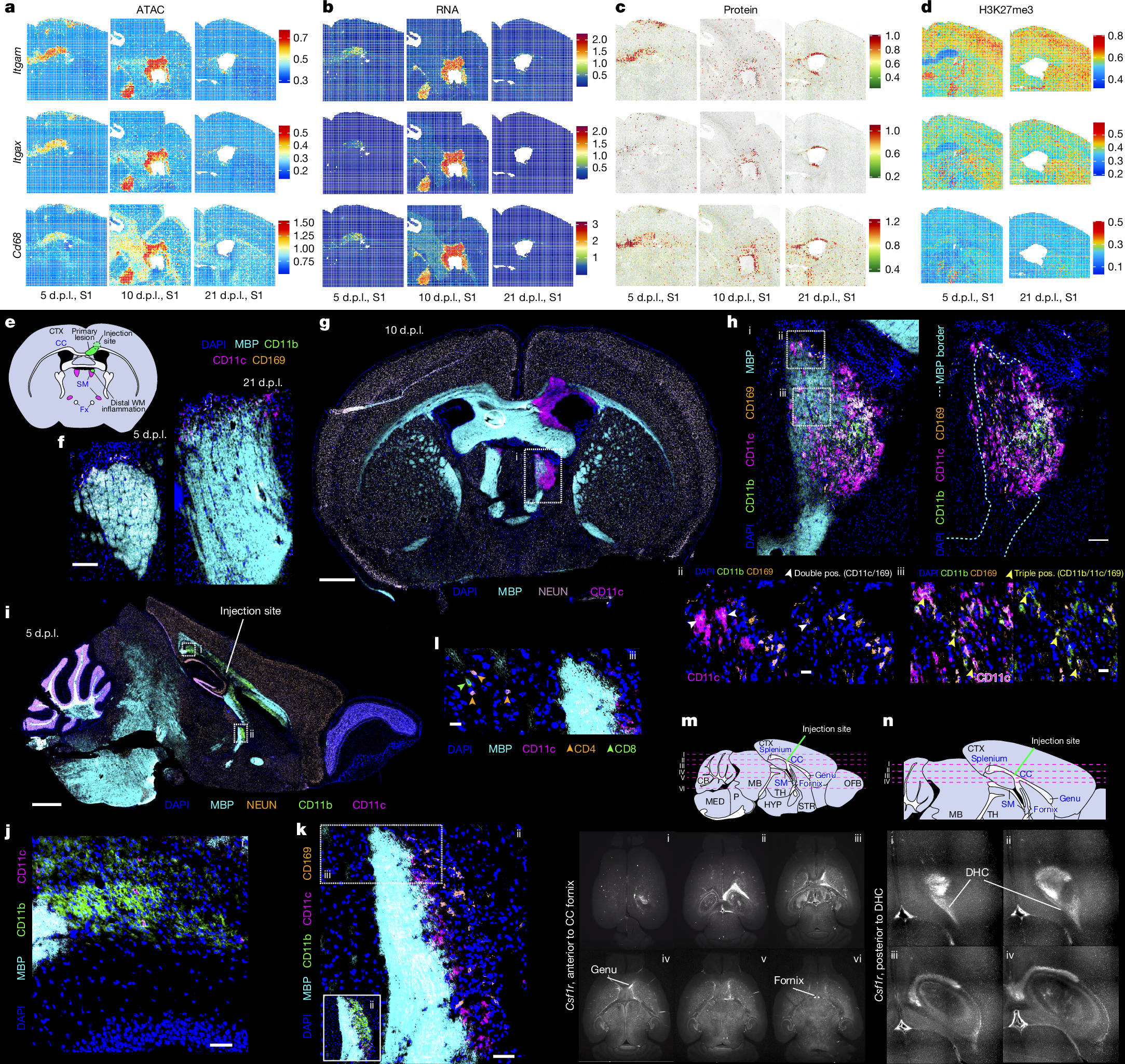 Fig. 5: CD11c+ microglia emerge in distal WM regions.