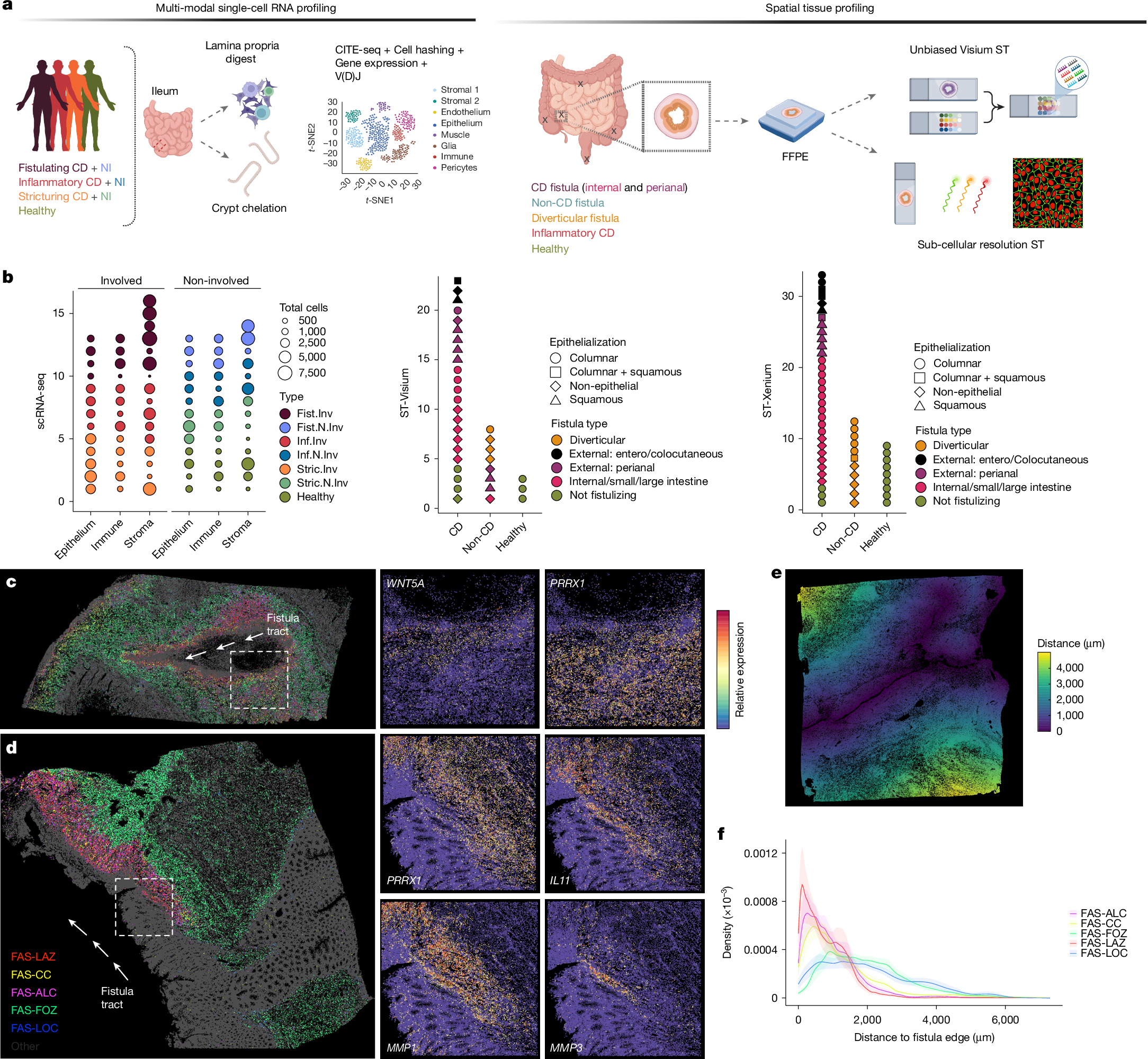 Fig. 1: Fistula-associated fibroblast states lining fistula tracts.