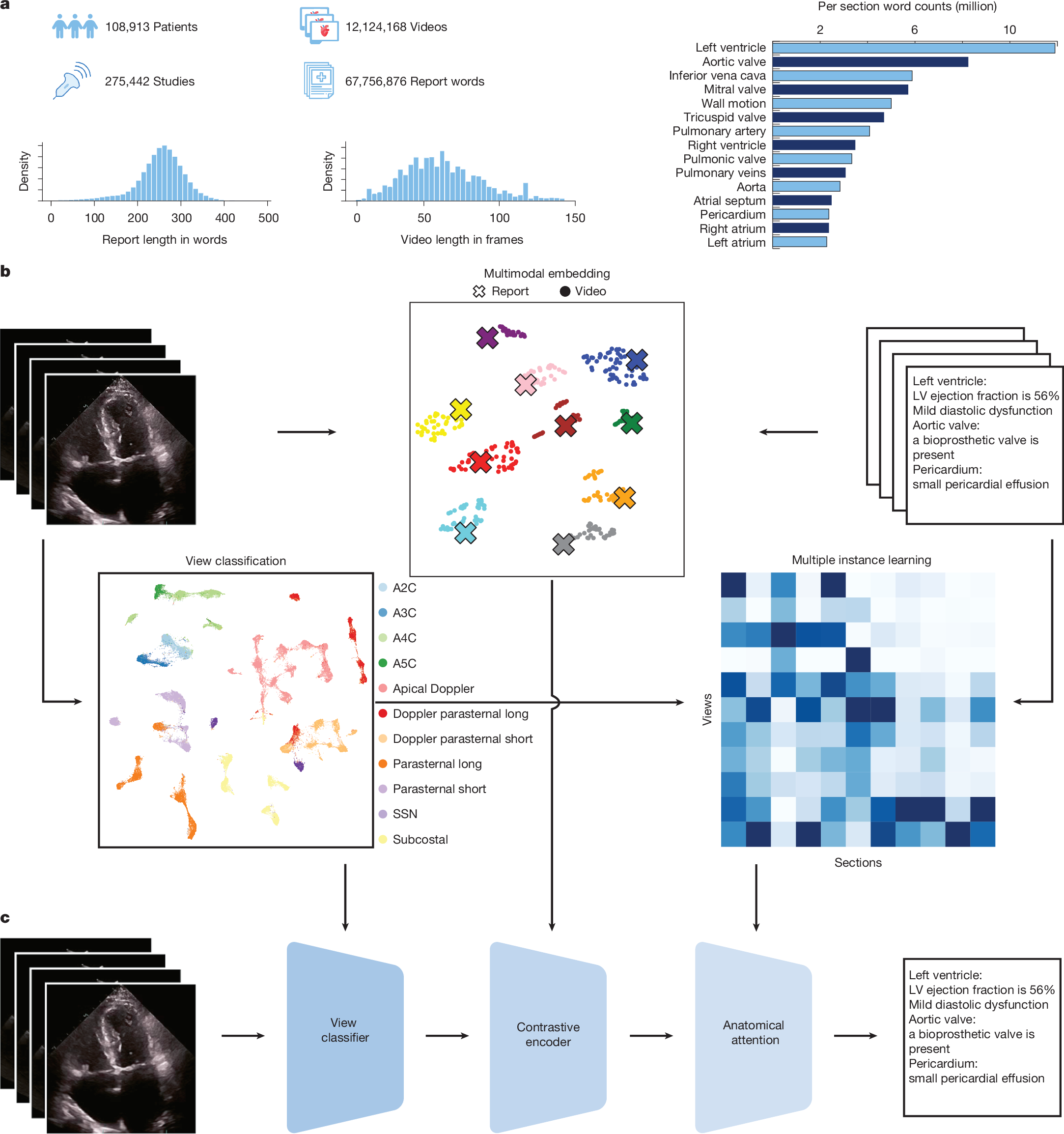 Comprehensive echocardiogram evaluation with view primed vision language AI  | Nature