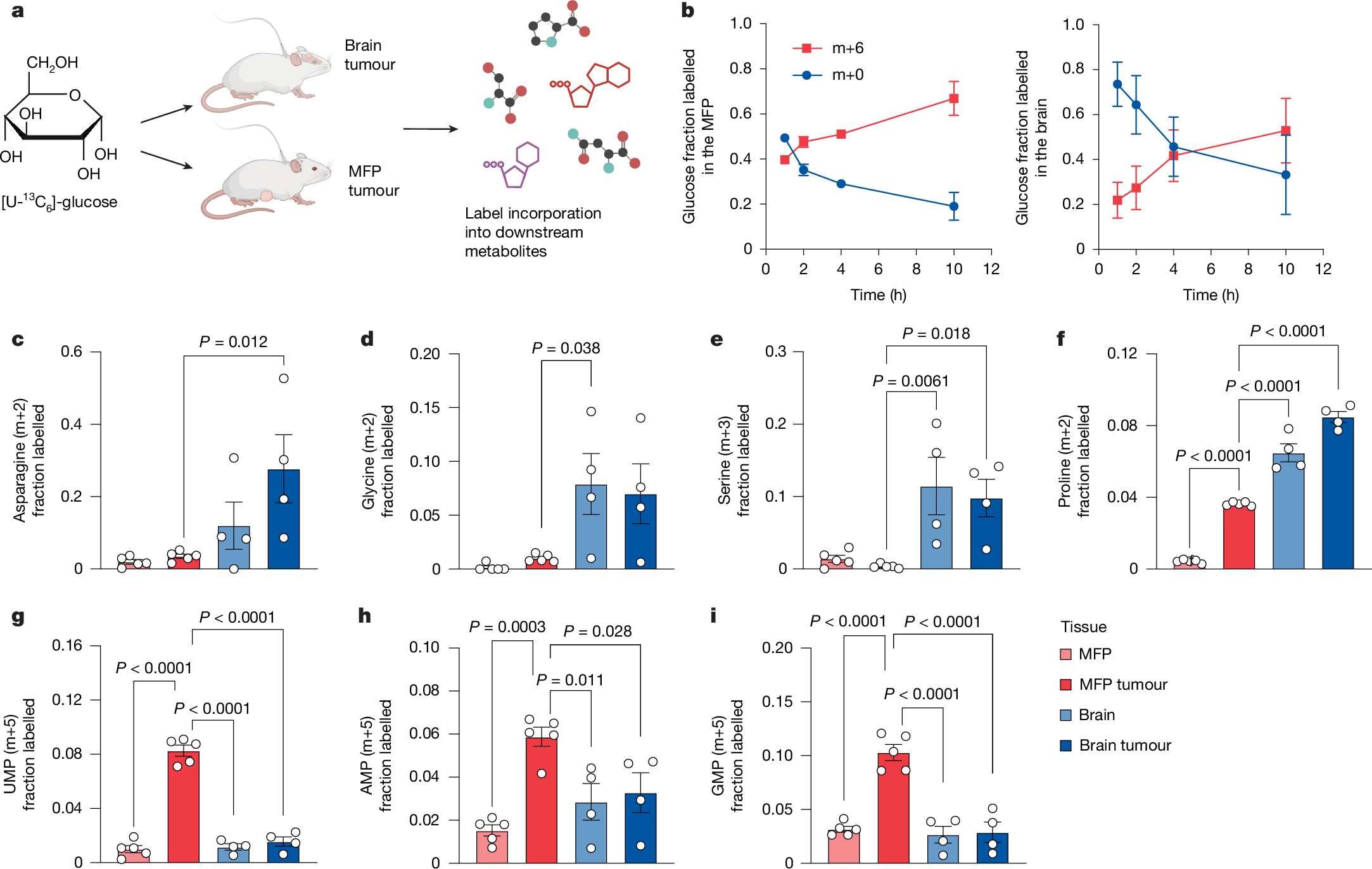 Fig. 4: Assessment of metabolite fate in primary and brain metastatic breast cancers.