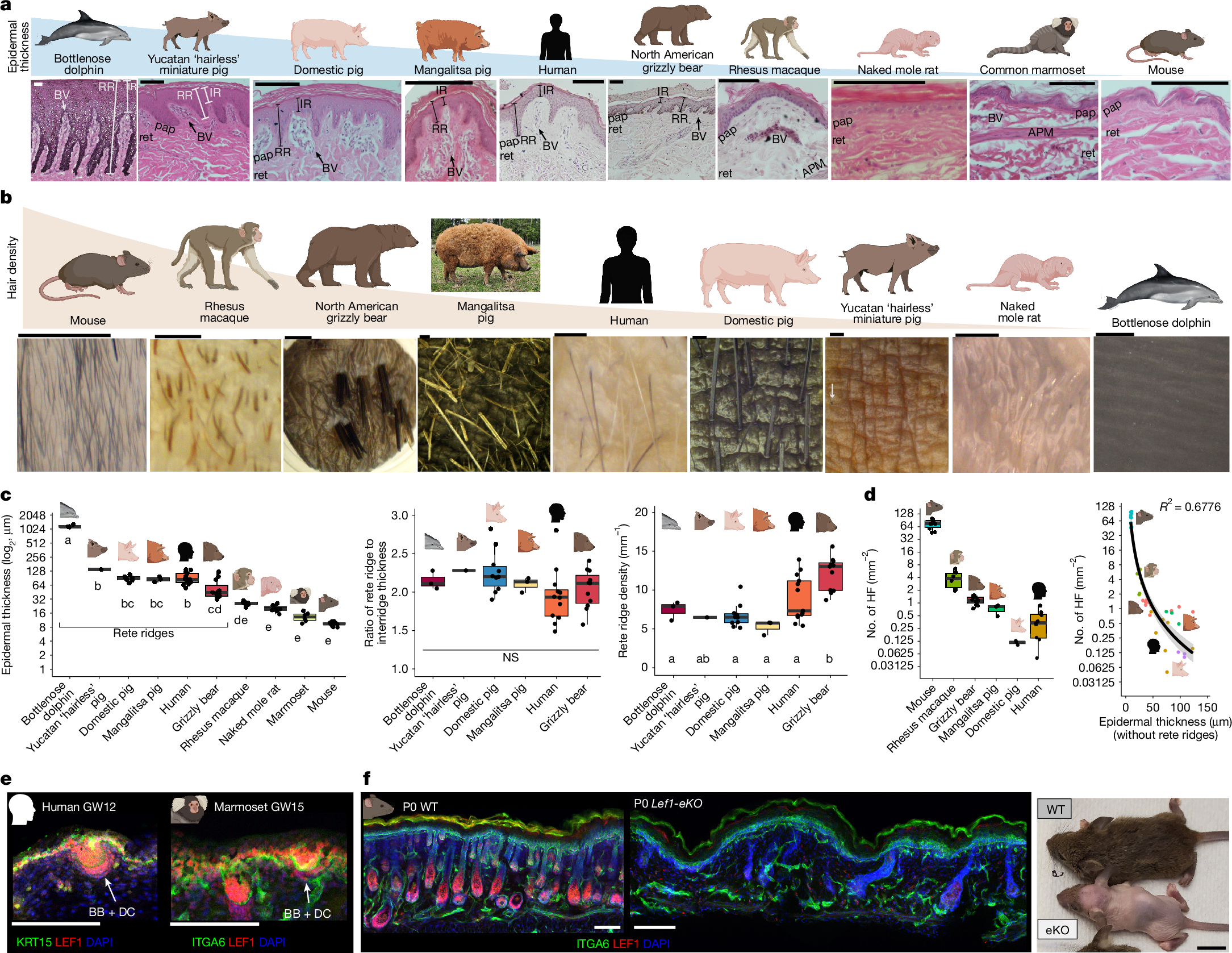 Fig. 2: Rete ridges support epidermal thickening.