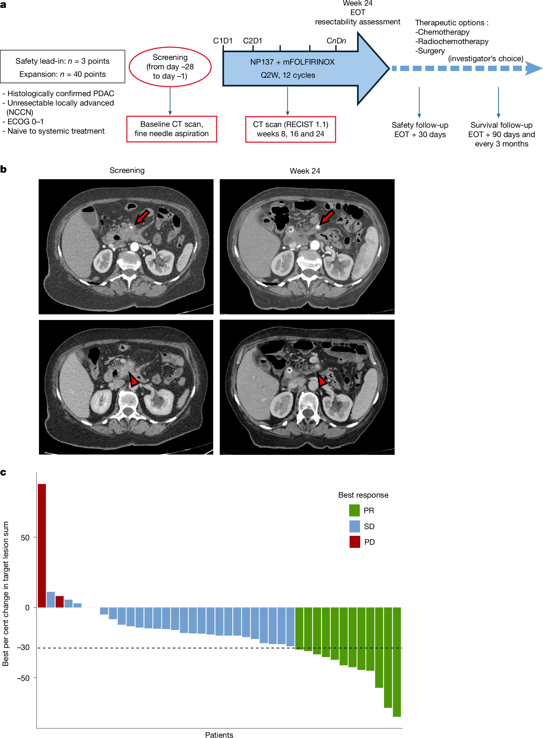 膵臓がんに対する抗体が初期臨床試験で有効性を示す（Pancreatic cancer: an antibody proves itself in an early clinical trial）