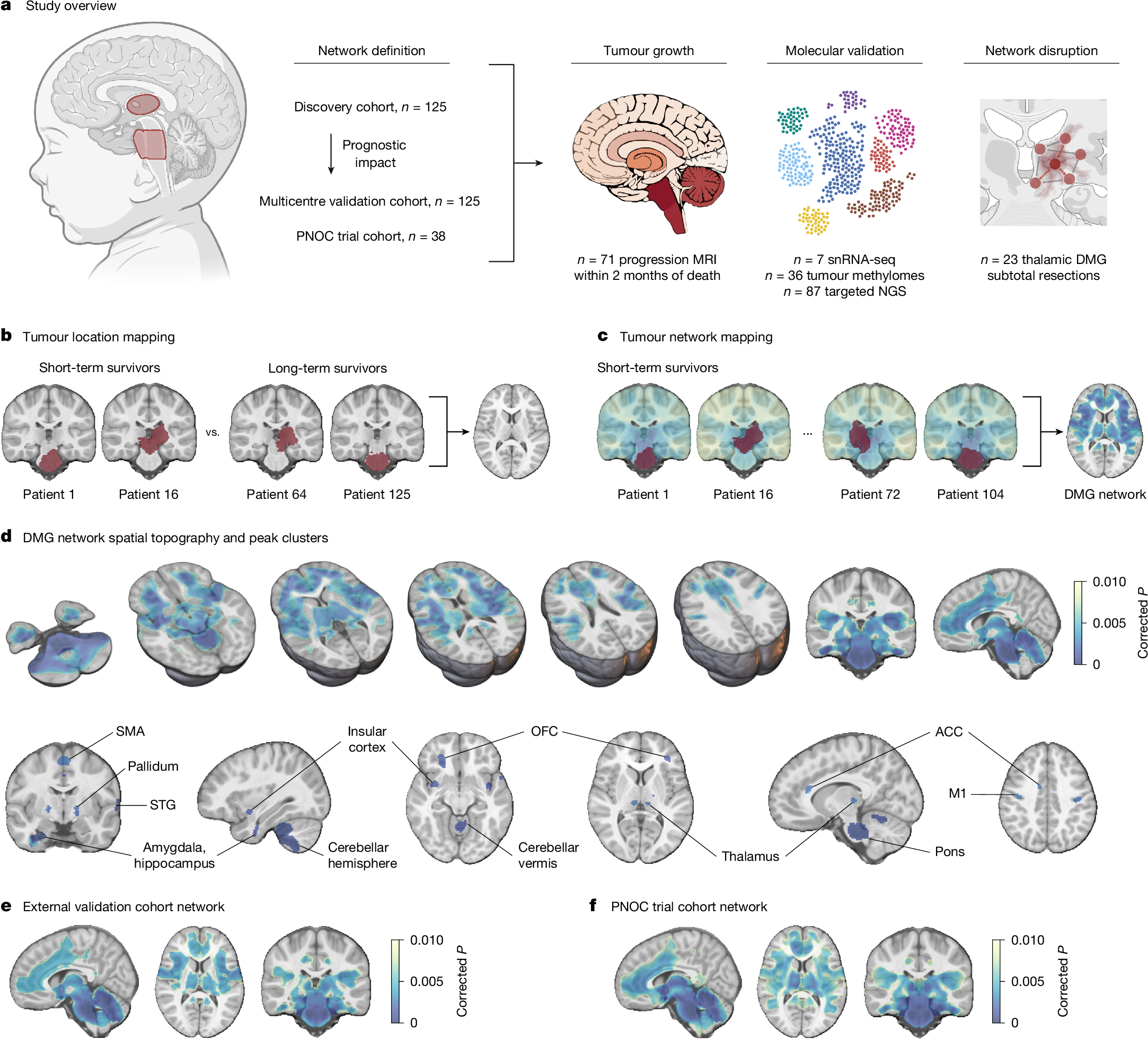 Fig. 1: Pontine and thalamic DMG map to a conserved, prognostic brain network.