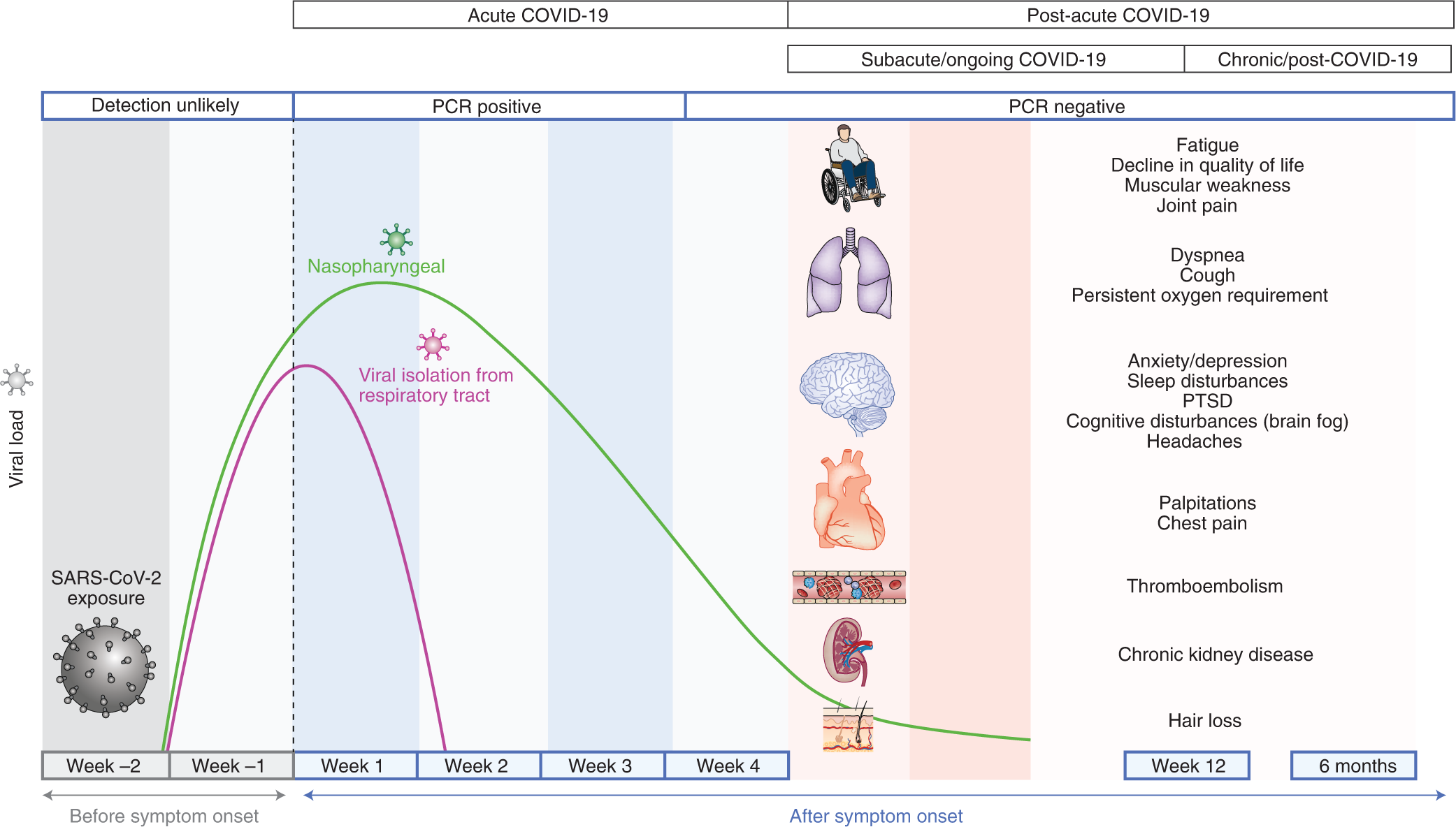 Portland Postural Orthostatic Tachycardia Syndrome Lawyer