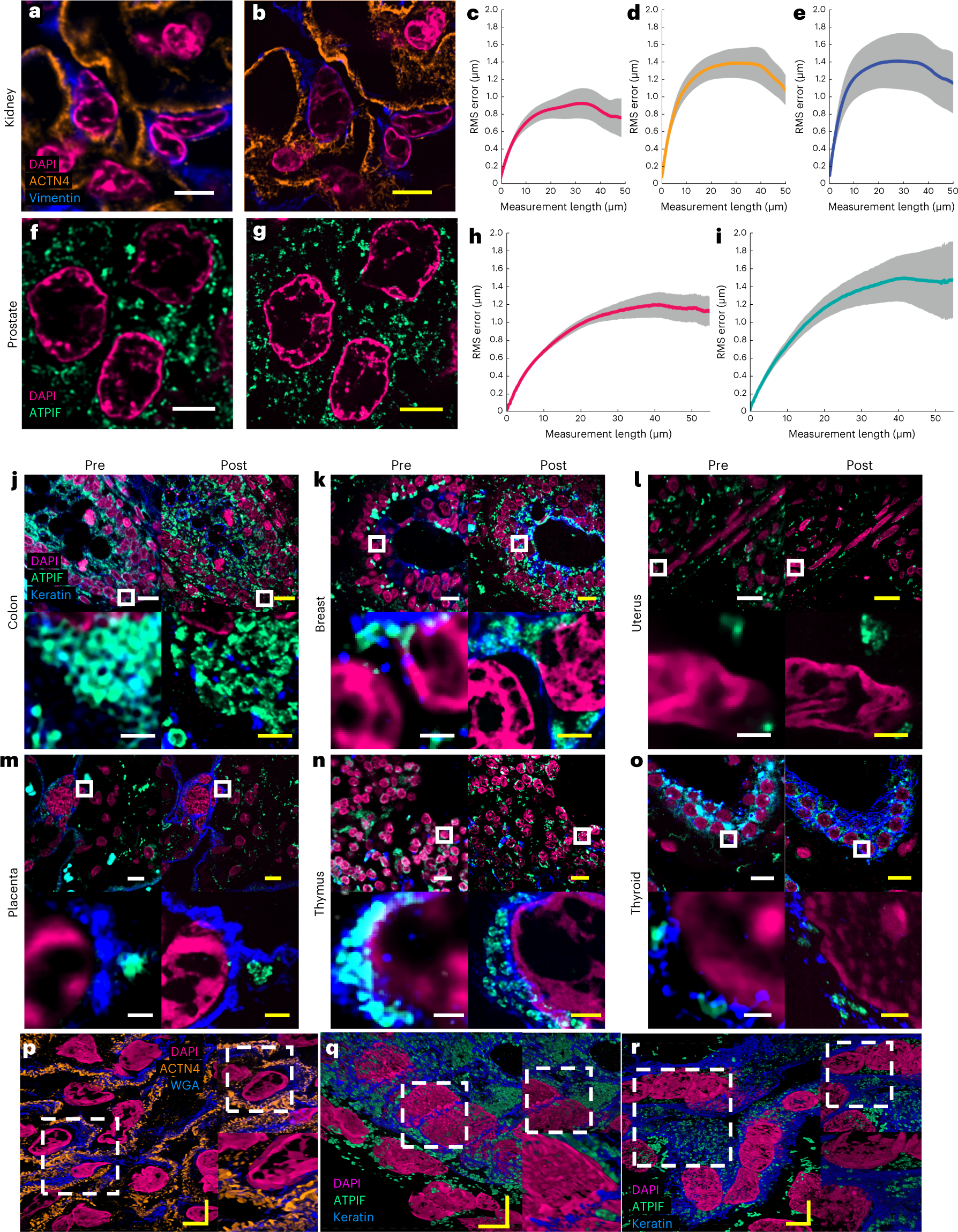 Fig. 2: Validation of Magnify in several tissue types.