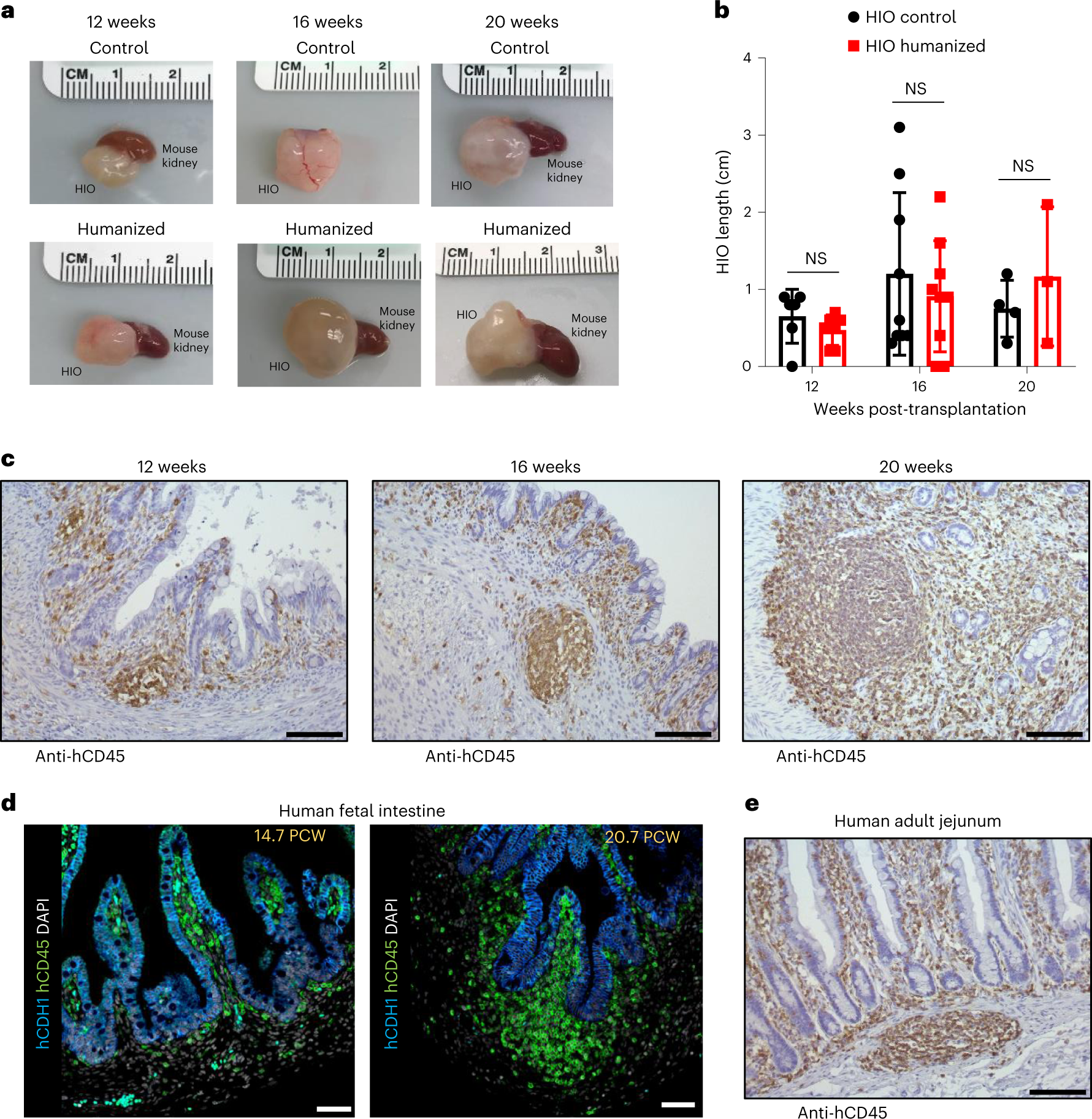 In vivo development of immune tissue in human intestinal organoids  transplanted into humanized mice | Nature Biotechnology