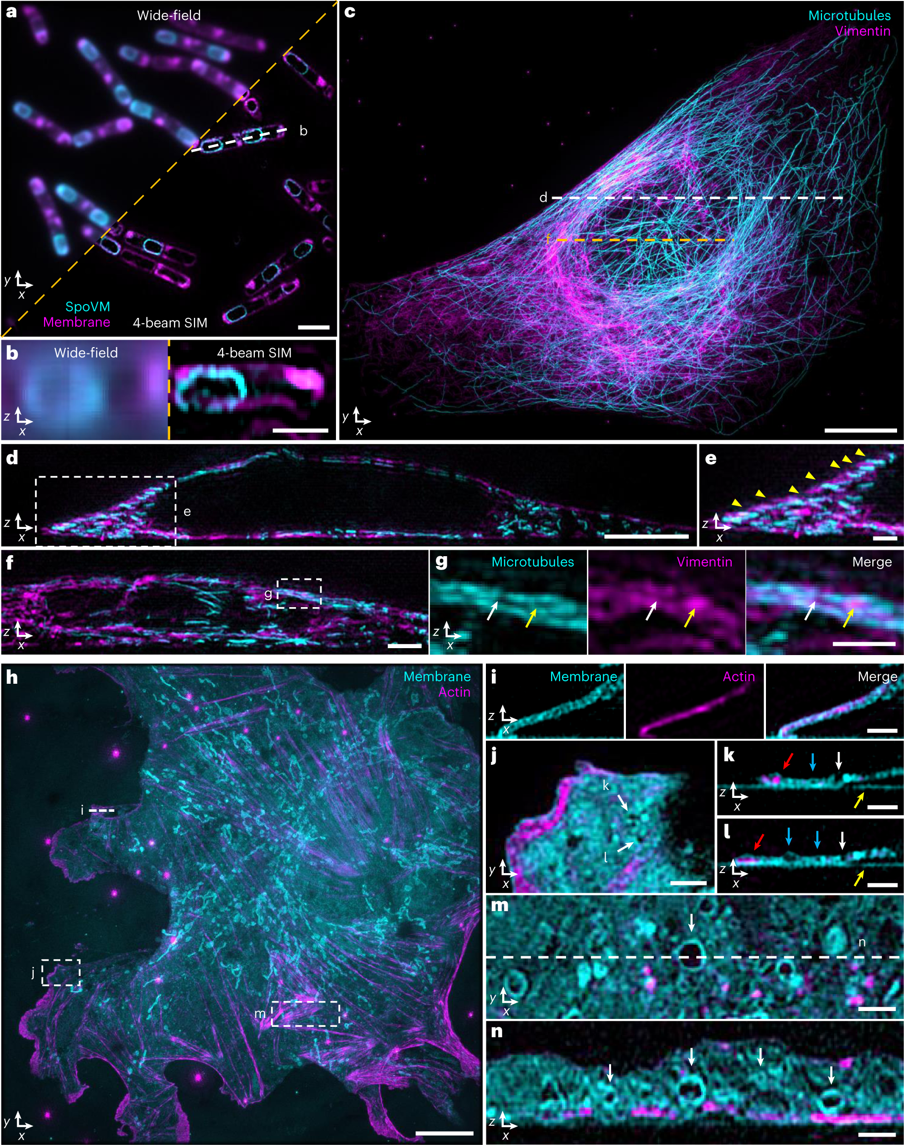 Fig. 3: Near-isotropic imaging in two colors via four-beam SIM.