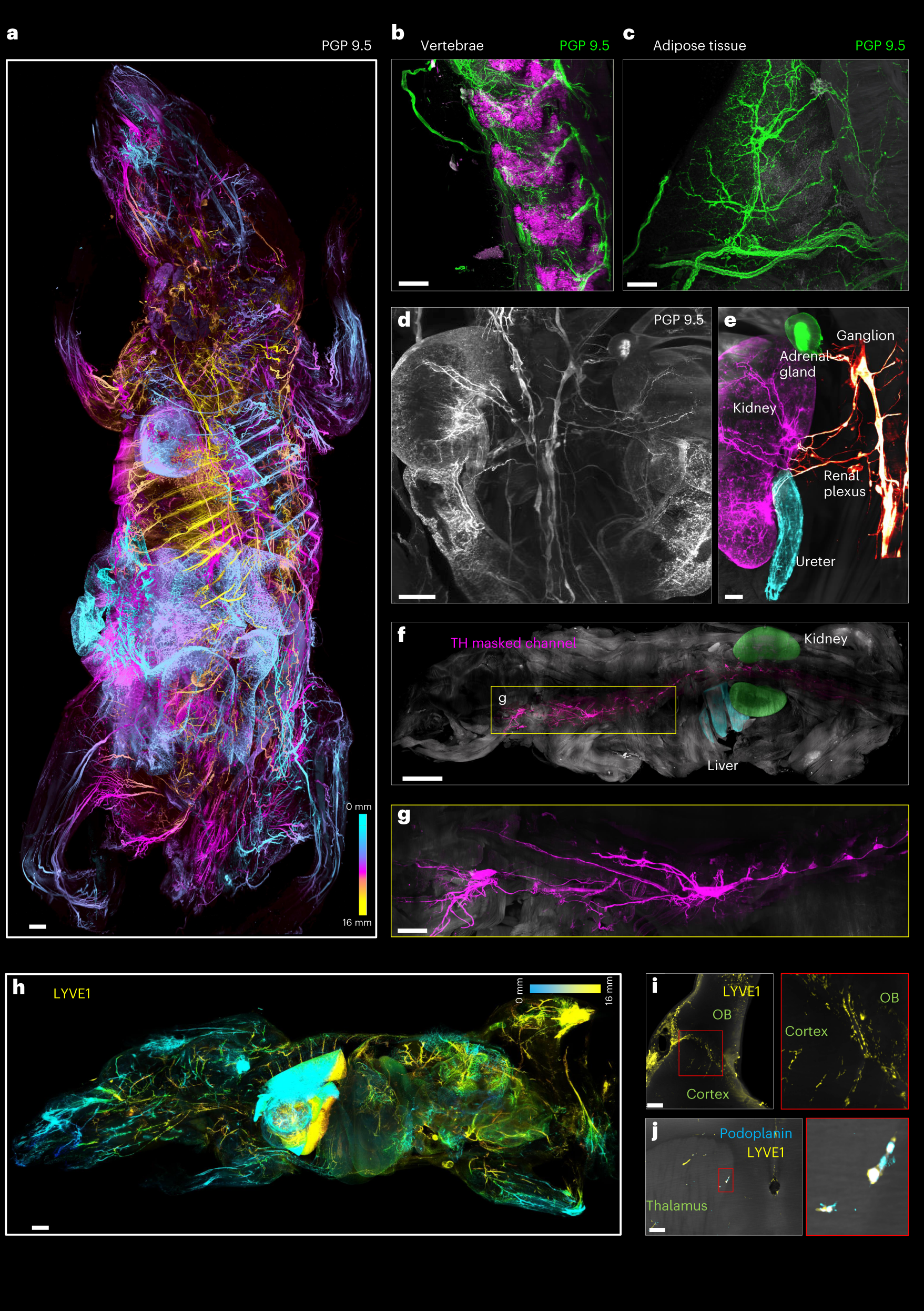 Fig. 2: Comprehensive neuroanatomical and lymphatic mapping of the whole mouse body using wildDISCO.