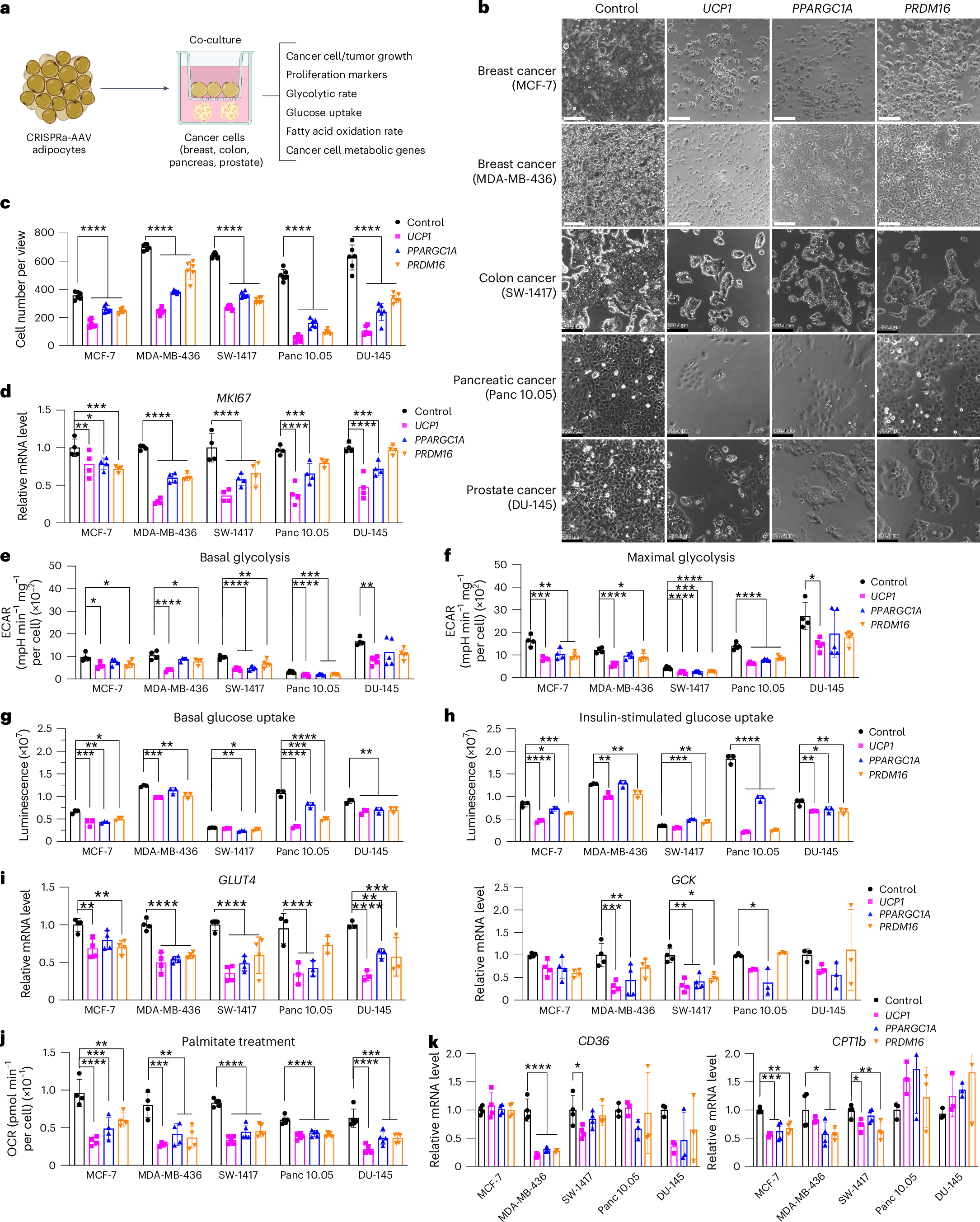 脂肪細胞ががんを飢えさせる可能性(How Hungry Fat Cells Could Someday Starve Cancer to Death)