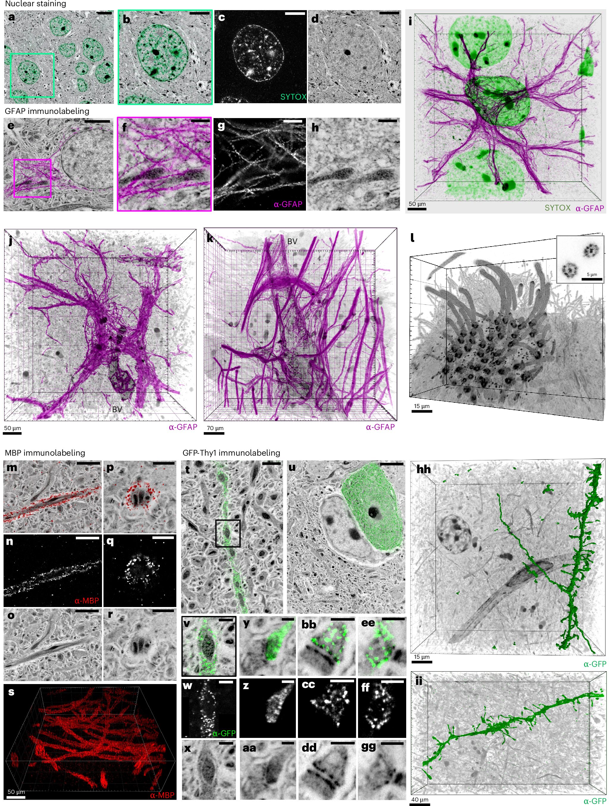 Fig. 4: pan-ExM-t is compatible with antibody labeling of brain tissue structural markers.