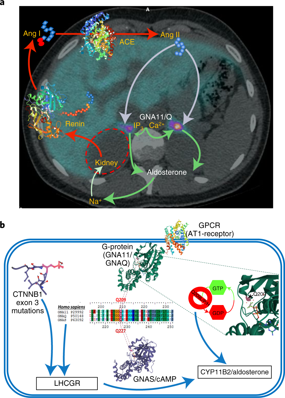 Somatic Mutations Of Gna11 And Gnaq In Ctnnb1 Mutant Aldosterone Producing Adenomas Presenting In Puberty Pregnancy Or Menopause Nature Genetics