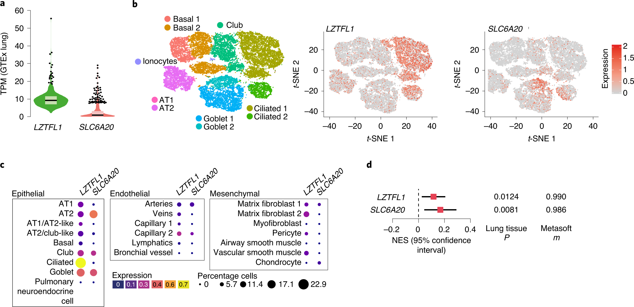 Fig. 4: Pulmonary expression analysis of LZTFL1 and SLC6A20.