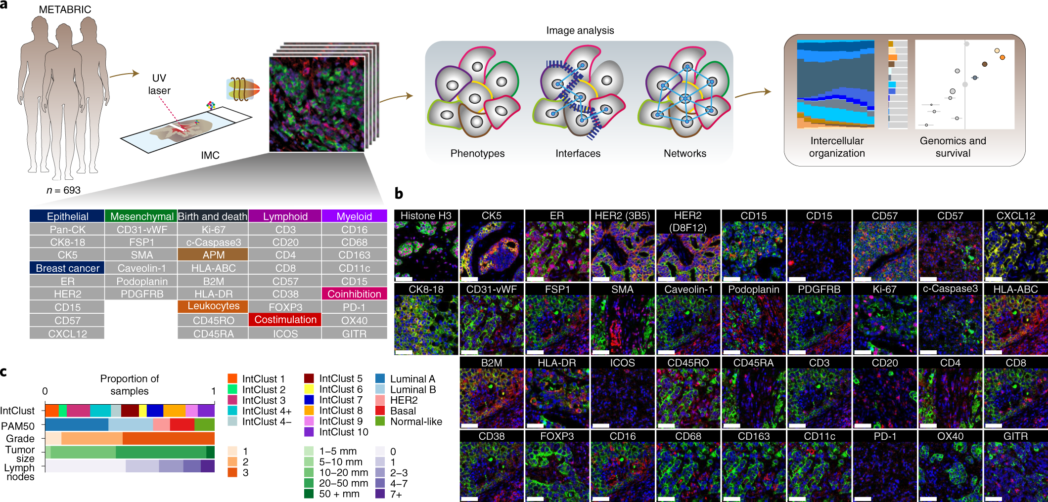 Breast tumor microenvironment structures are associated with
