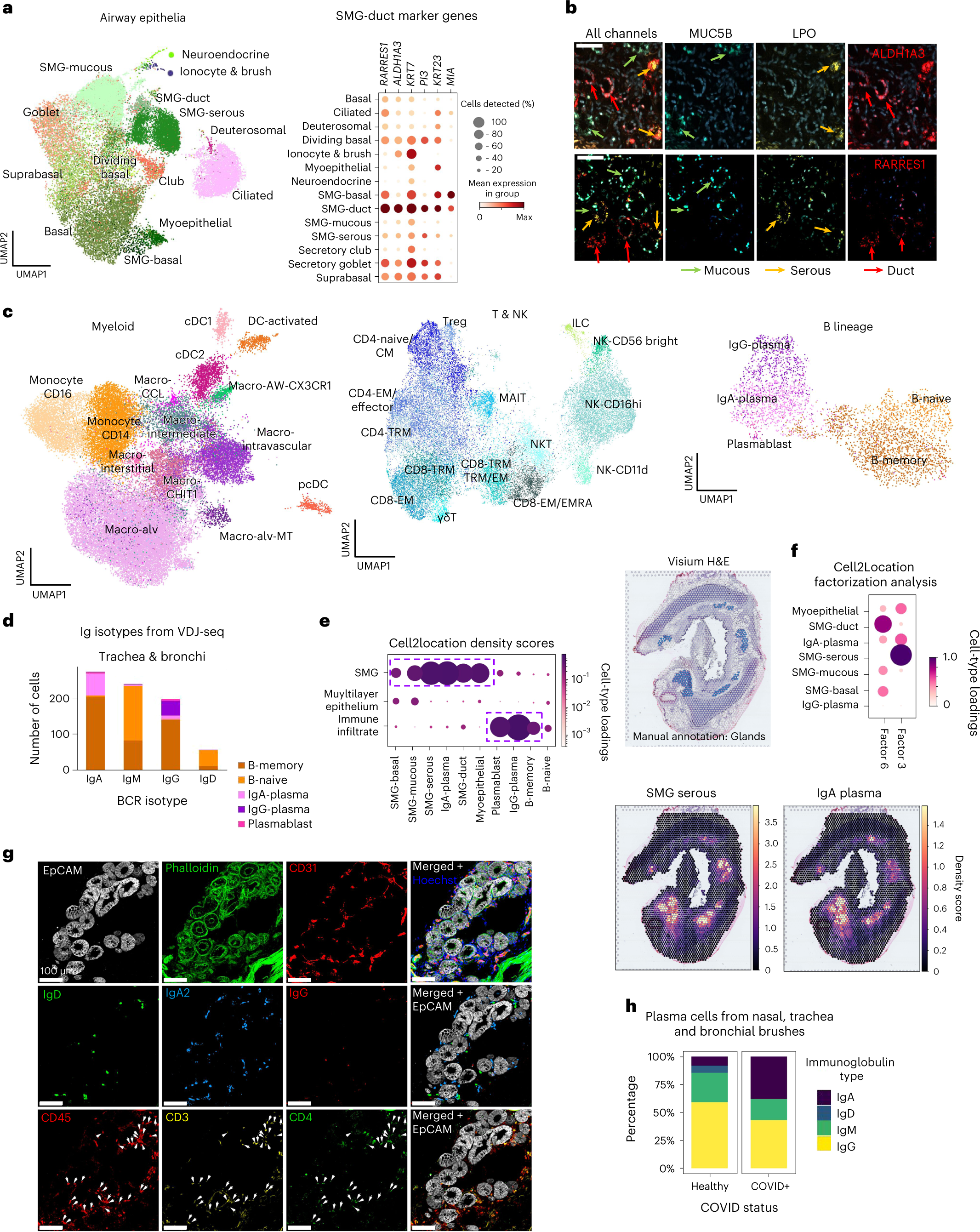 Fig. 4: IgA plasma cells in human airways colocalize with SMGs.