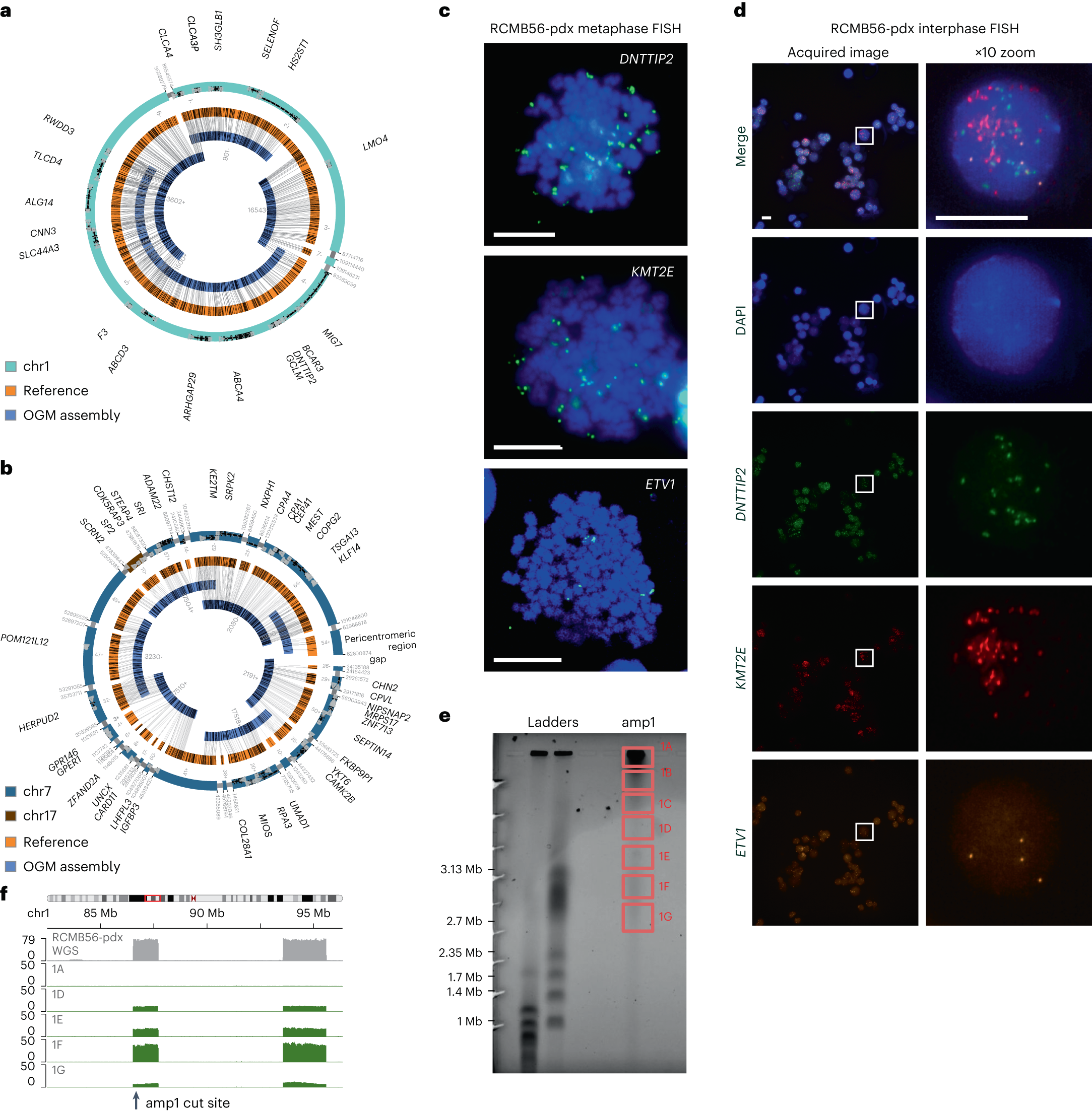 Fig. 2: Distinct high-copy extrachromosomal amplifications coexist in a SHH medulloblastoma tumor.