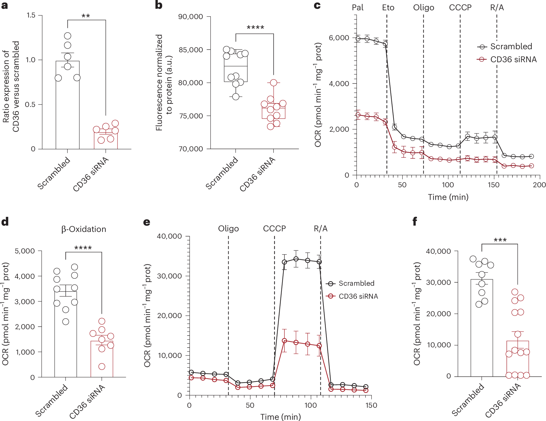 Fig. 4: Effect of CD36 knockdown on fatty acid uptake and mitochondrial function in human CMs.