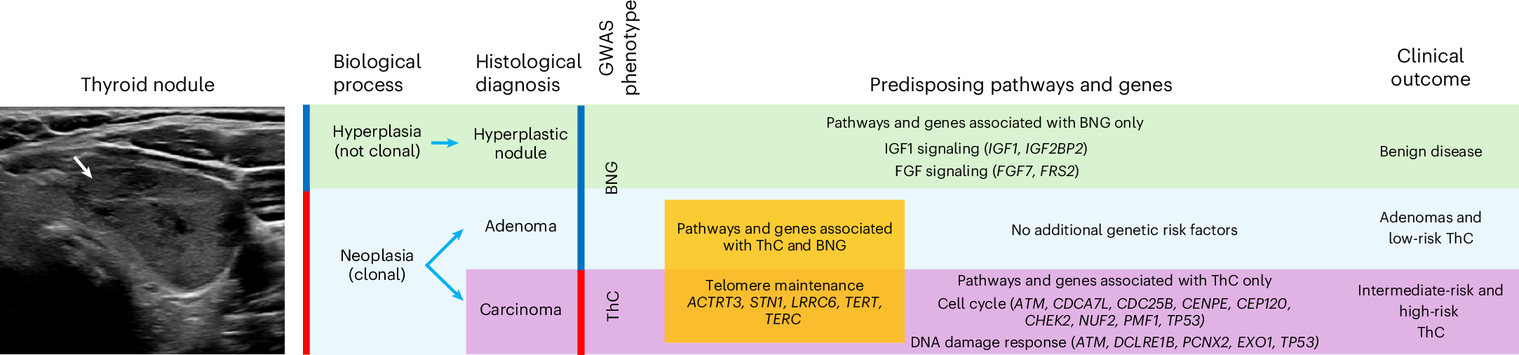 Fig. 4: Germline genetic susceptibility to ThC and BNG.