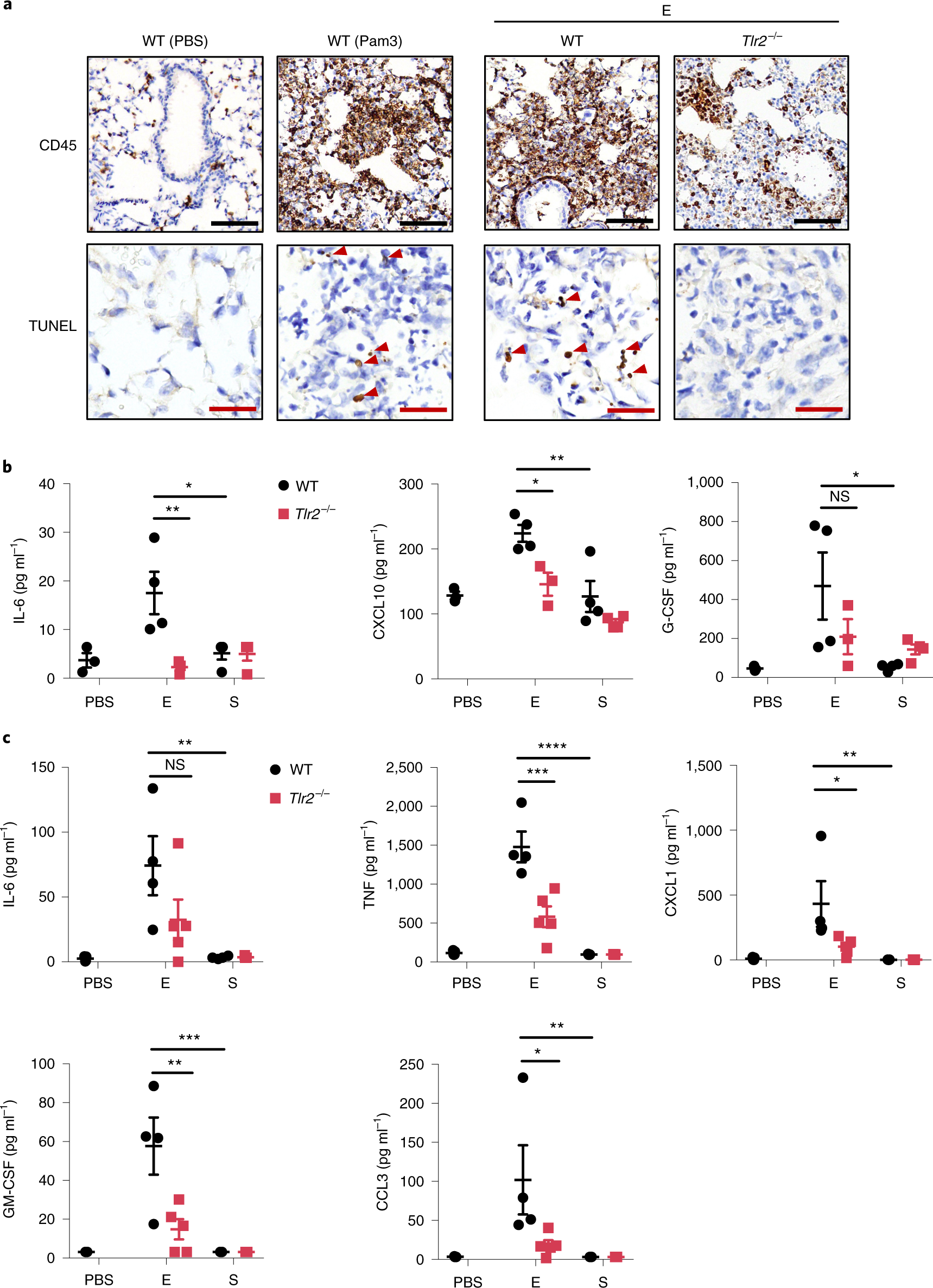 Fig. 4: The E protein of SARS-CoV-2 can induce TLR2-dependent inflammation and damage in the lungs.