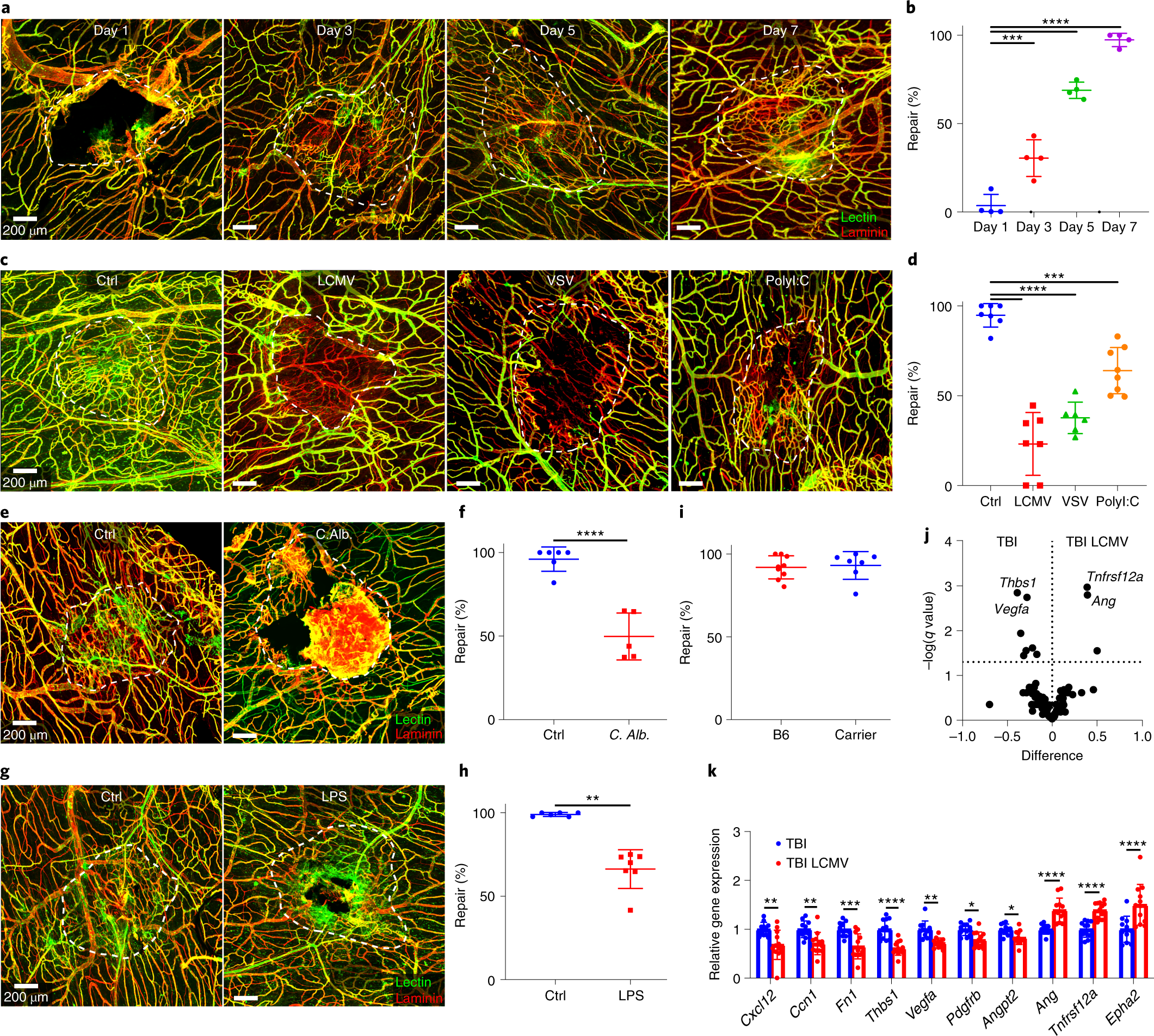 Antimicrobial Immunity Impedes Cns Vascular Repair Following Brain Injury Nature Immunology