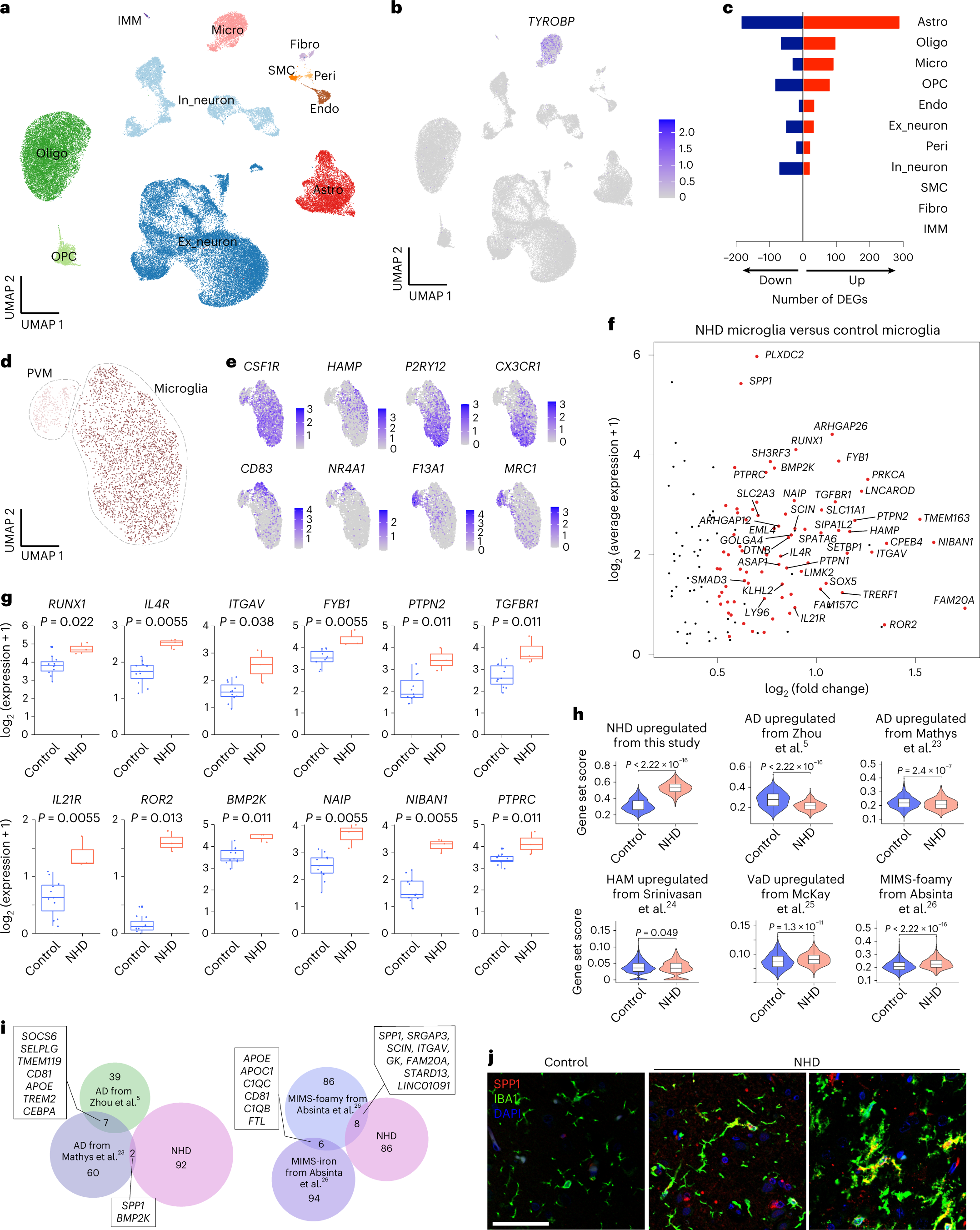 Human early-onset dementia caused by DAP12 deficiency reveals a unique  signature of dysregulated microglia | Nature Immunology