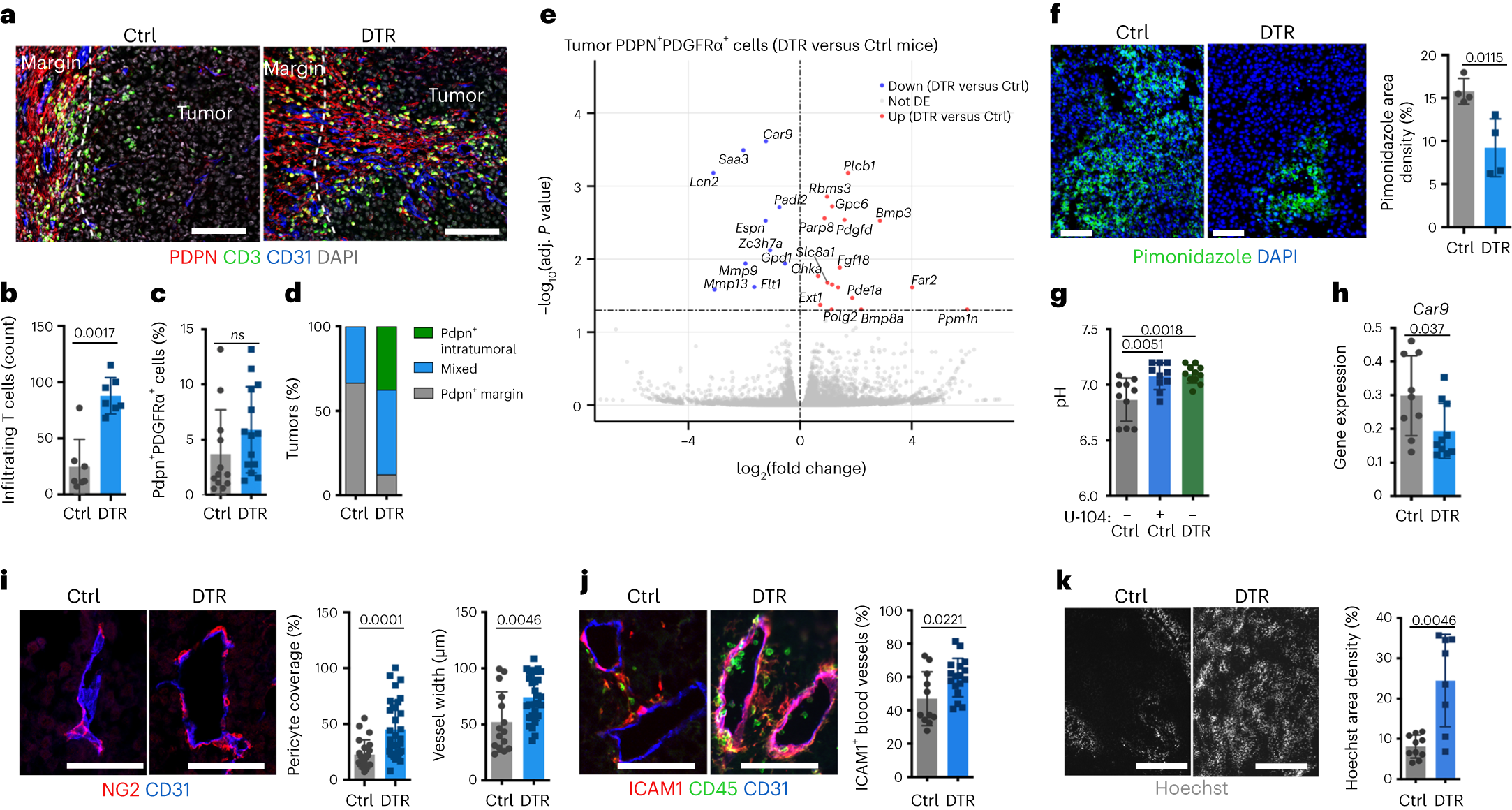 Fig. 2: Depletion of ADAM12+ MSCs normalizes the stromal/vascular TME.