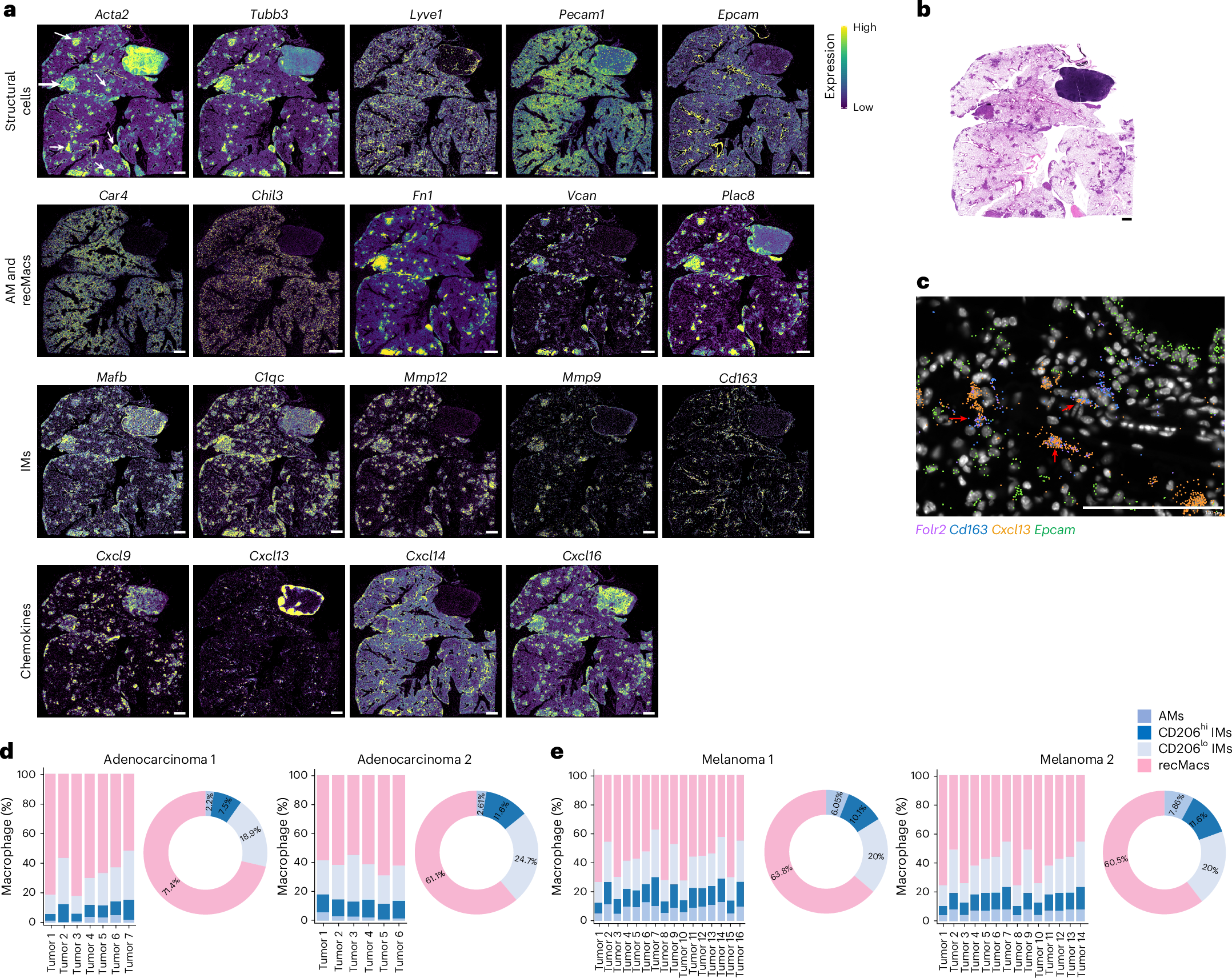 Fig. 3: Compartmentalized IM and recMac populations organize chemokine landscapes in lung adenocarcinoma.