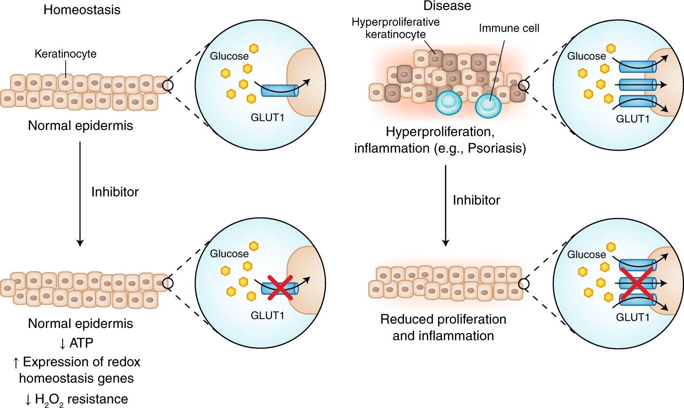 glutathione alcohol addiction Effects of GSH on Alcohol Metabolism and Hangover Improvement in Humans: A  Randomized Double-Blind Placebo-Controlled Crossover Clinical Trial