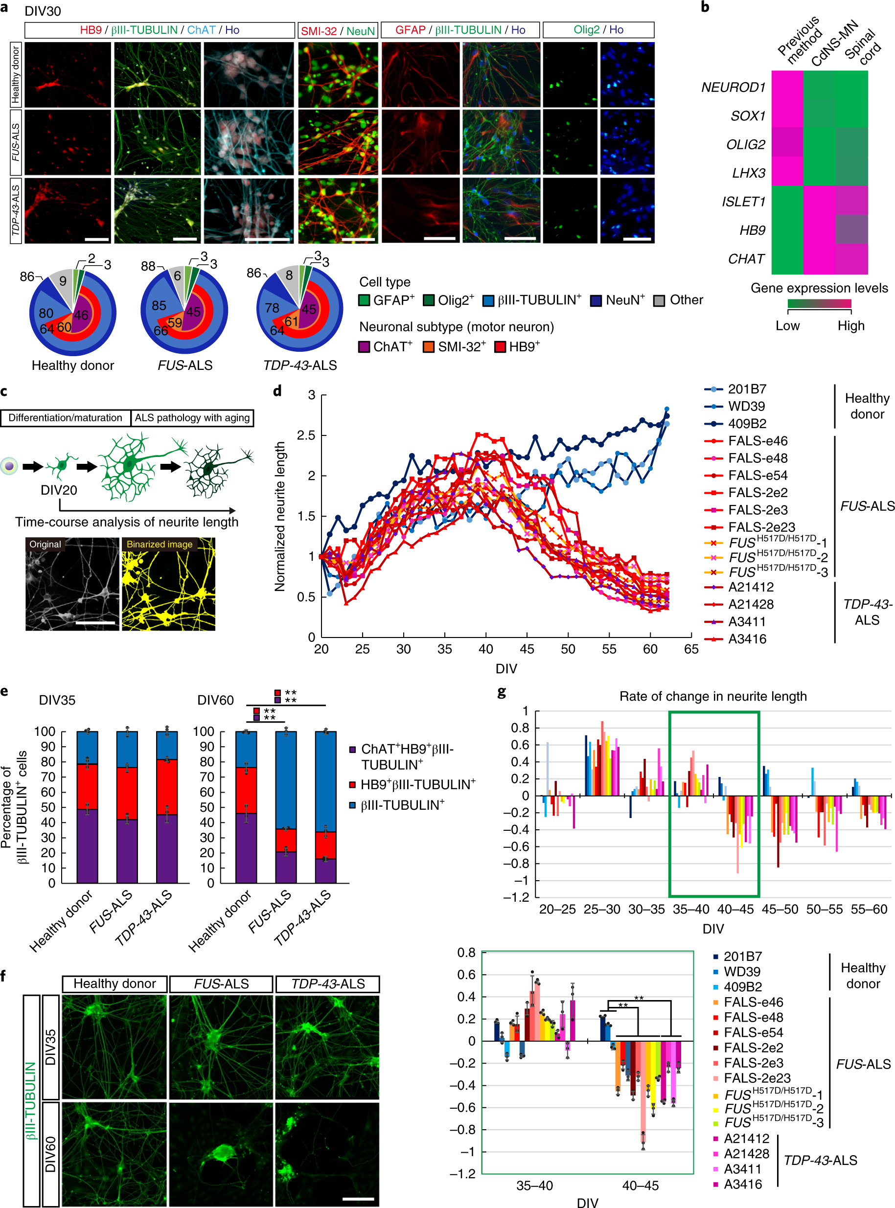 Research Identifies Complex Of Neurons >> Modeling Sporadic Als In Ipsc Derived Motor Neurons Identifies A Research Identifies Complex Of Neurons >> Modeling Sporadic Als In Ipsc Derived Motor Neurons Identifies A