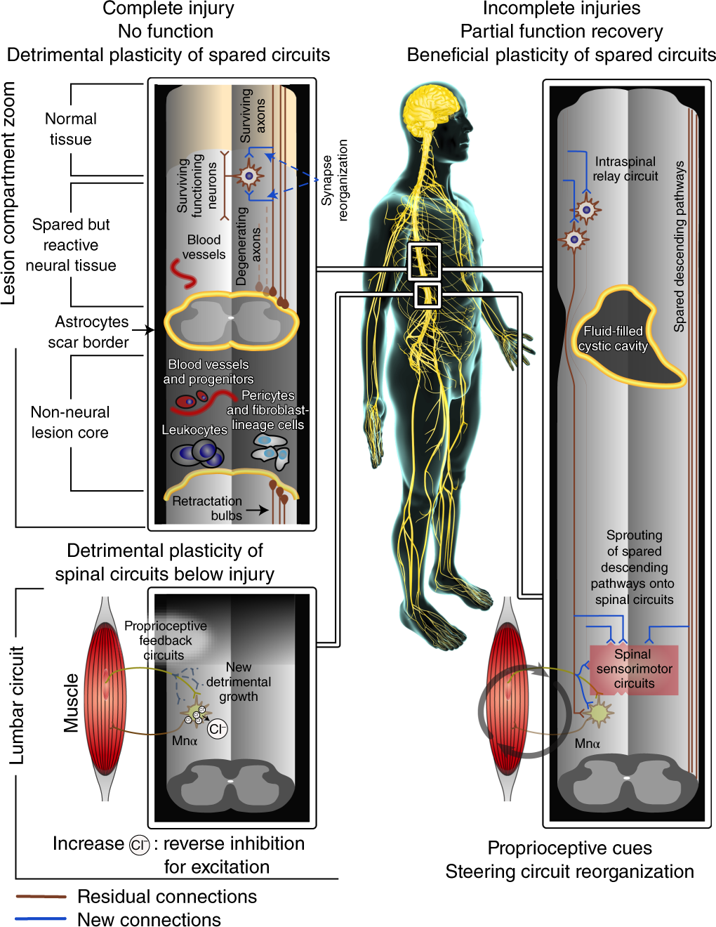 Spinal cord repair: advances in biology and technology | Nature Medicine