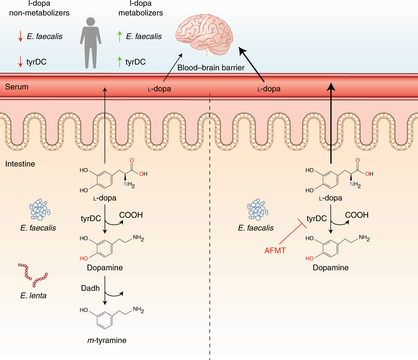 A novel pathway for microbial metabolism of levodopa | Nature Medicine