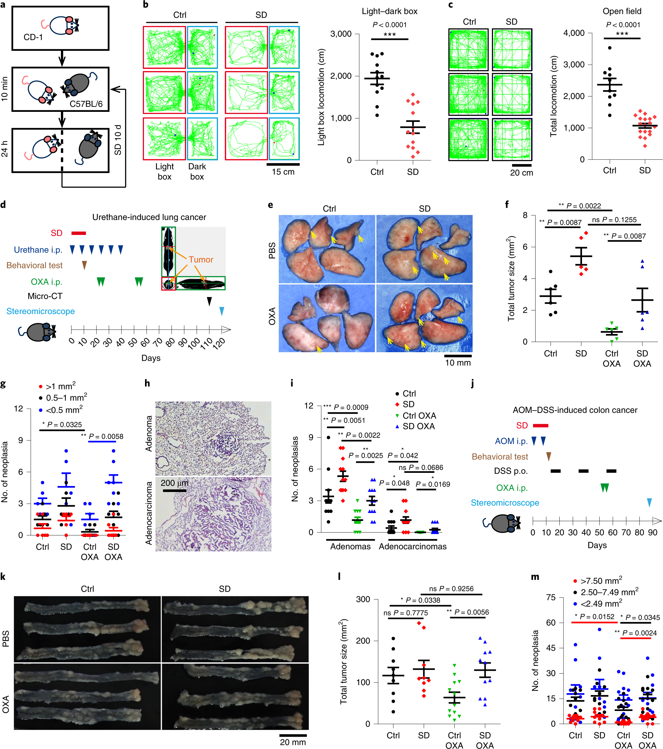 Stress–glucocorticoid–TSC22D3 axis compromises therapy-induced antitumor  immunity | Nature Medicine