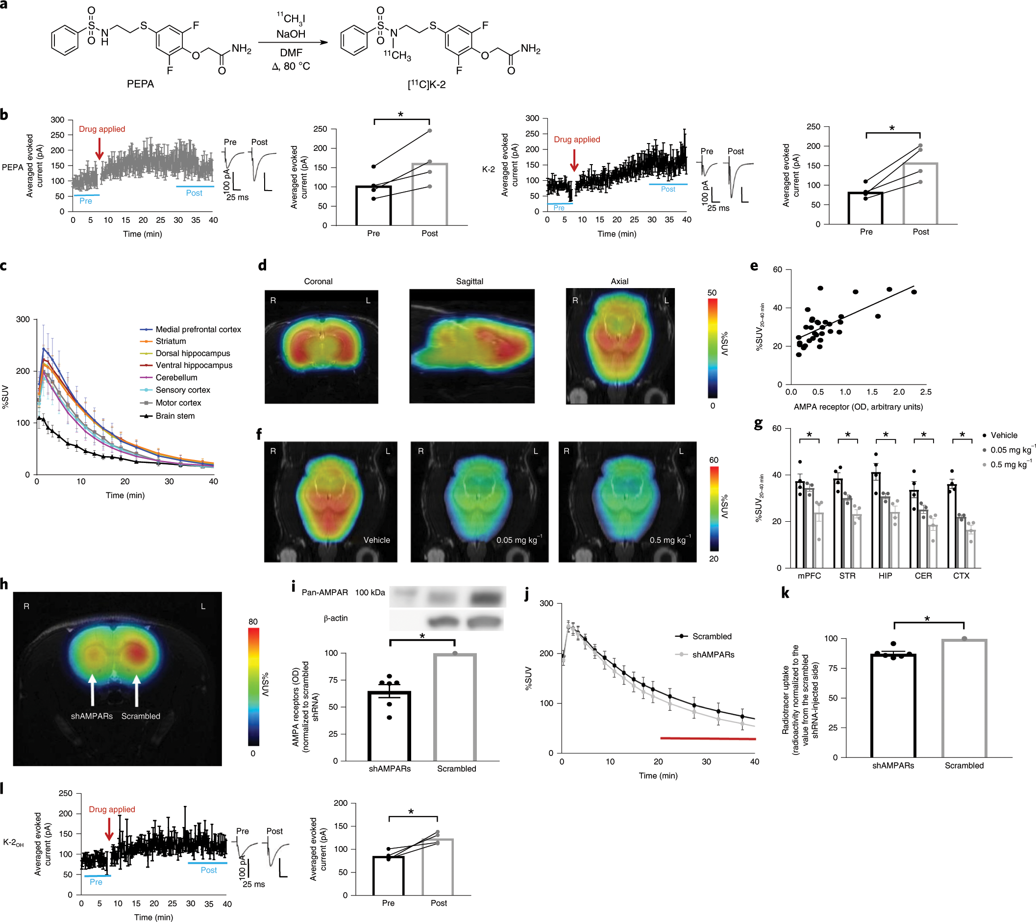 Visualization Of Ampa Receptors In Living Human Brain With Positron Emission Tomography Nature Medicine Visualization Of Ampa Receptors In Living Human Brain With Positron Emission Tomography Nature Medicine