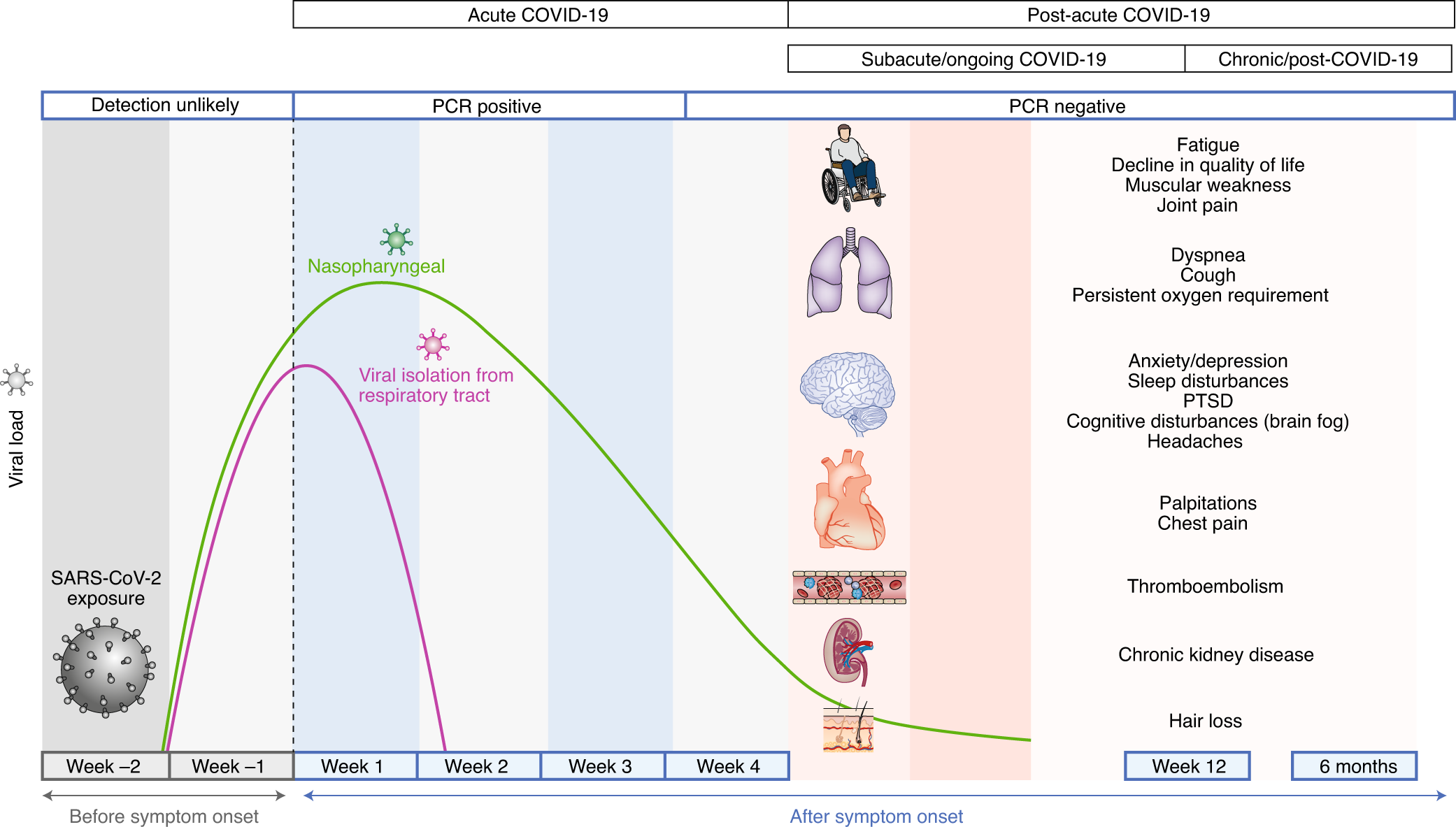 Post-acute COVID-19 syndrome | Nature Medicine