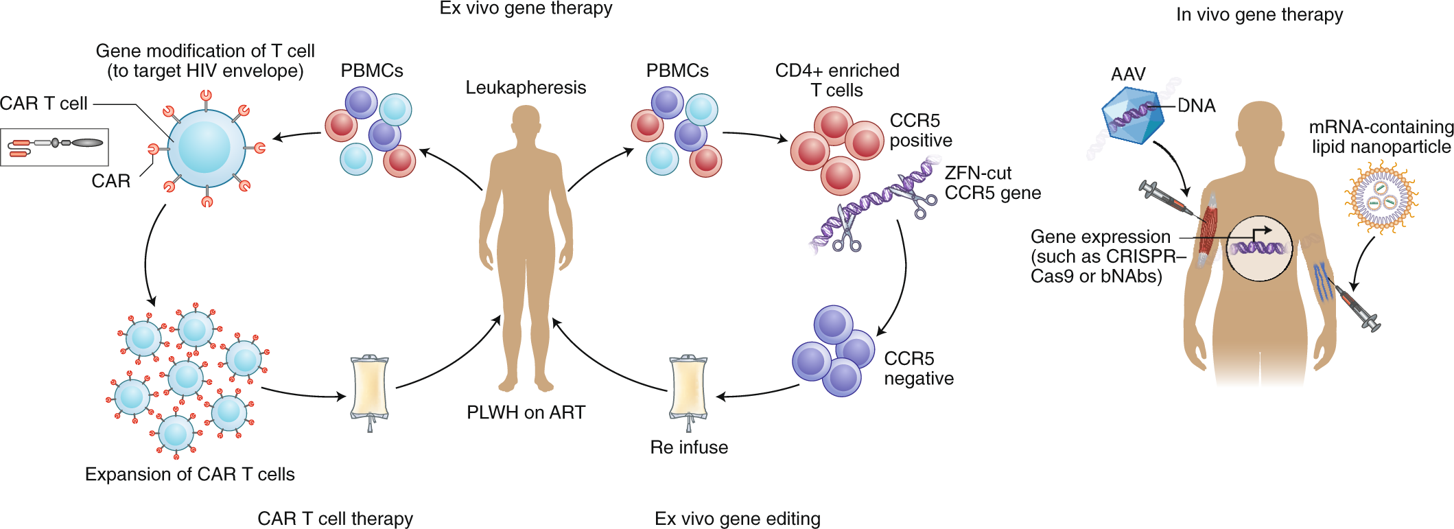 Fig. 4: Strategies for gene therapy.
