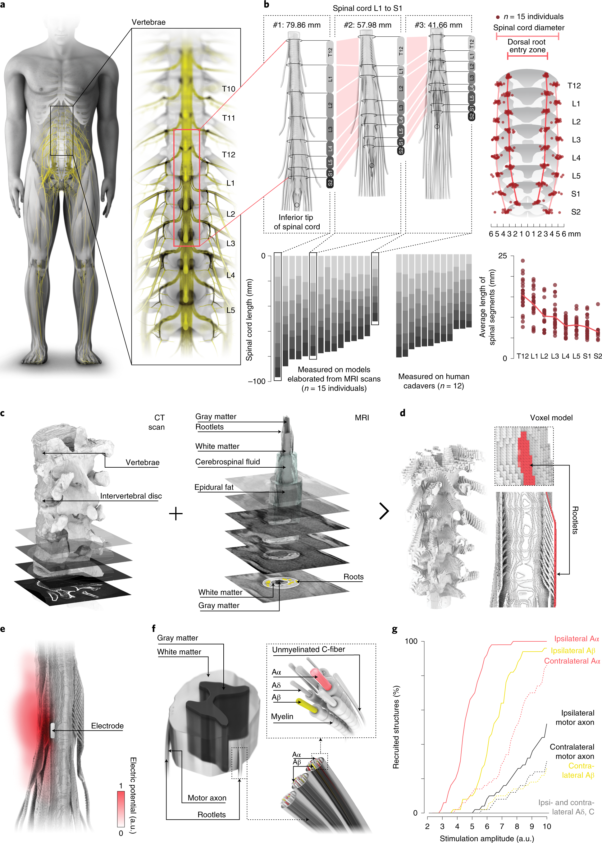 Epidural Spinal Cord Stimulation
