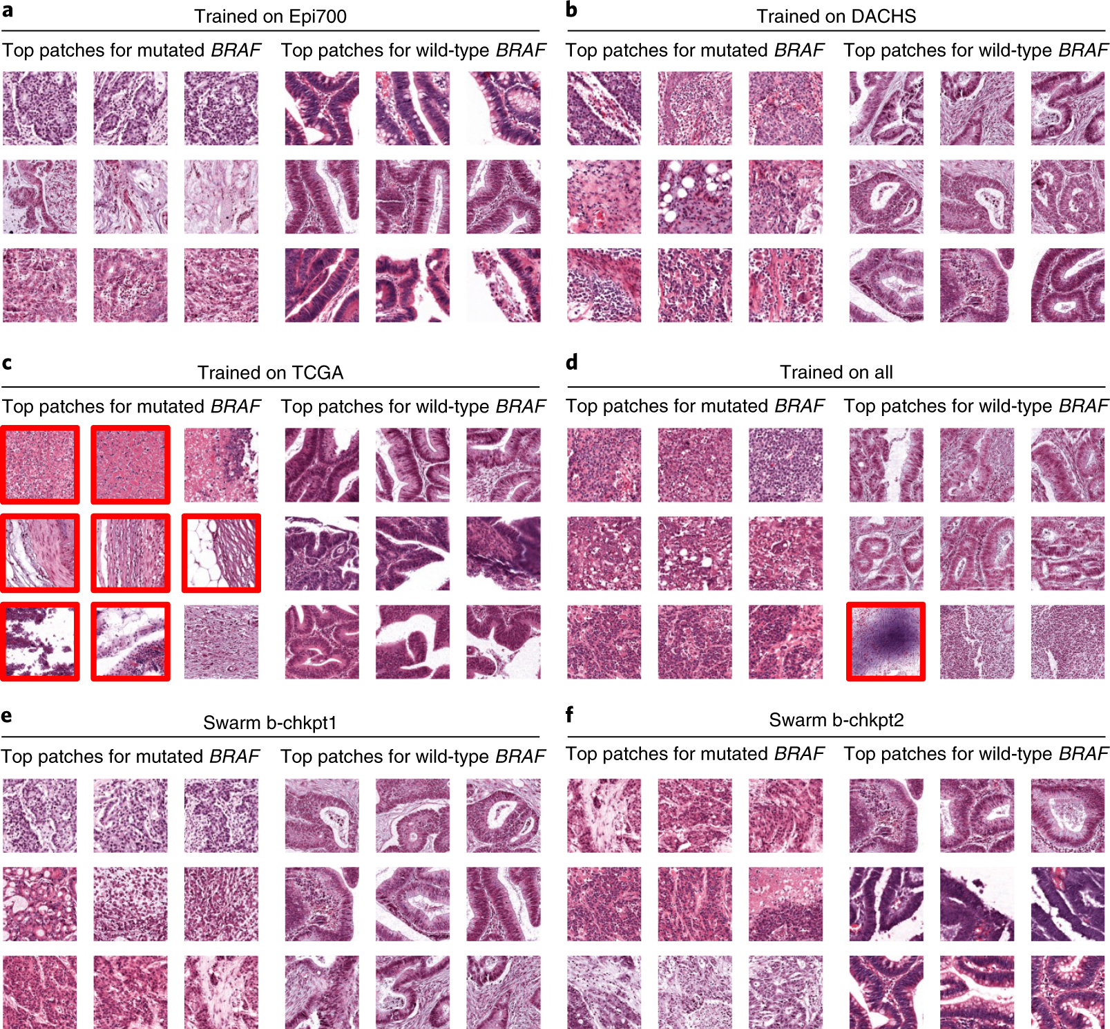 Fig. 4: Highly predictive image patches for BRAF prediction.