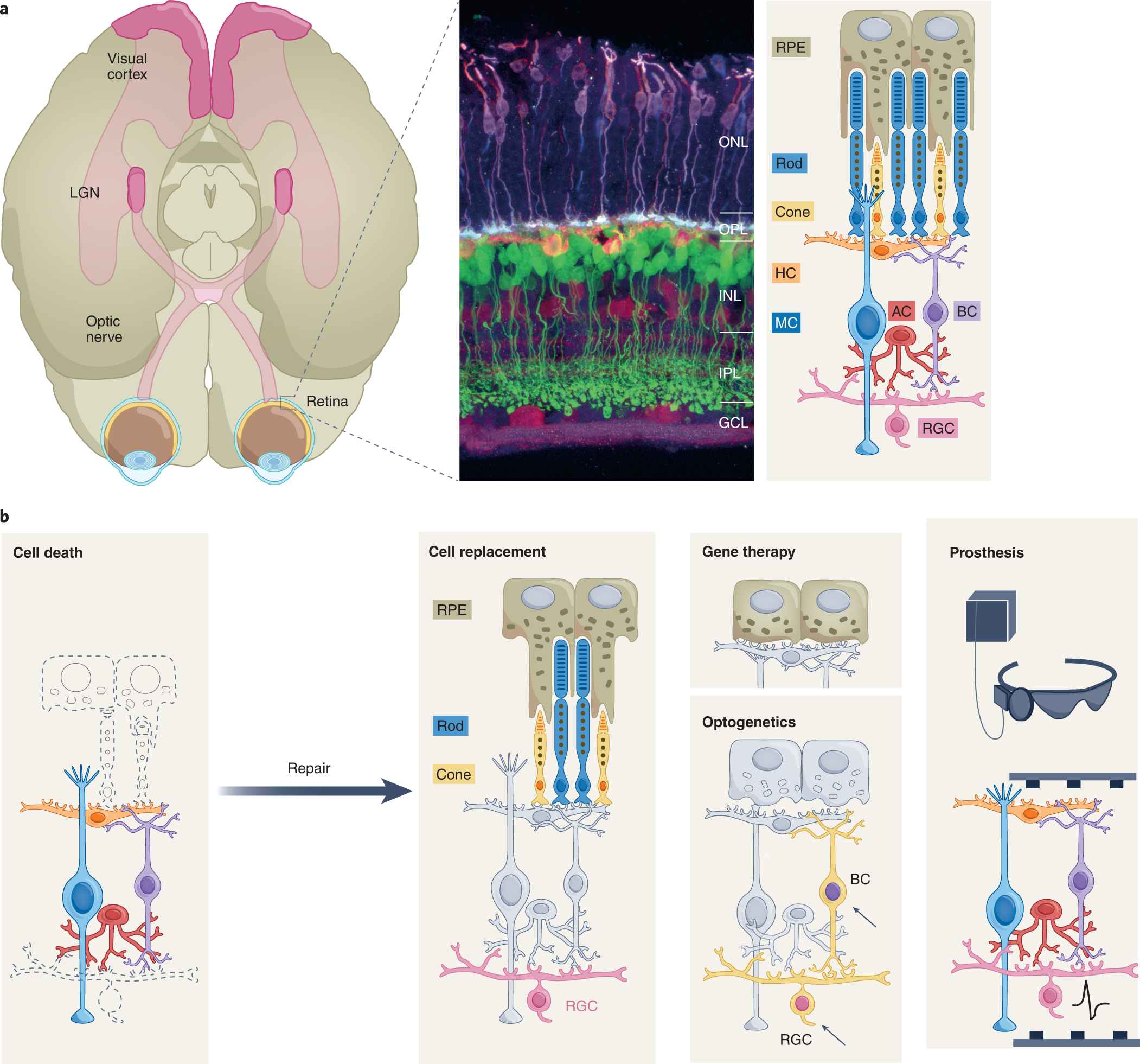 Cellular responses following retinal injuries and therapeutic approaches  for neurodegenerative diseases - ScienceDirect