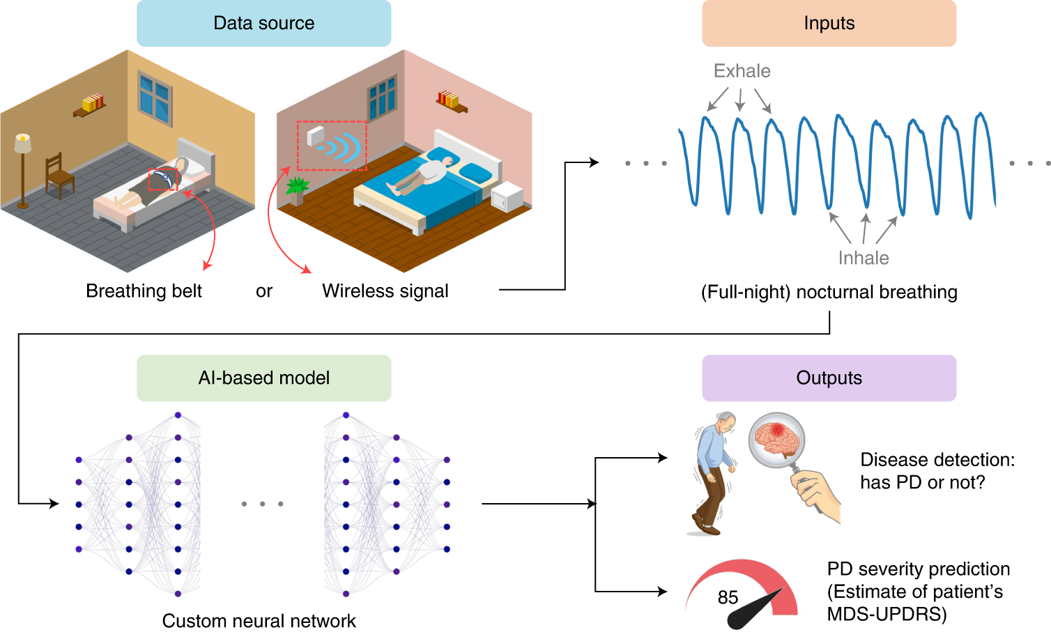Artificial intelligence-enabled detection and assessment of Parkinson's  disease using nocturnal breathing signals