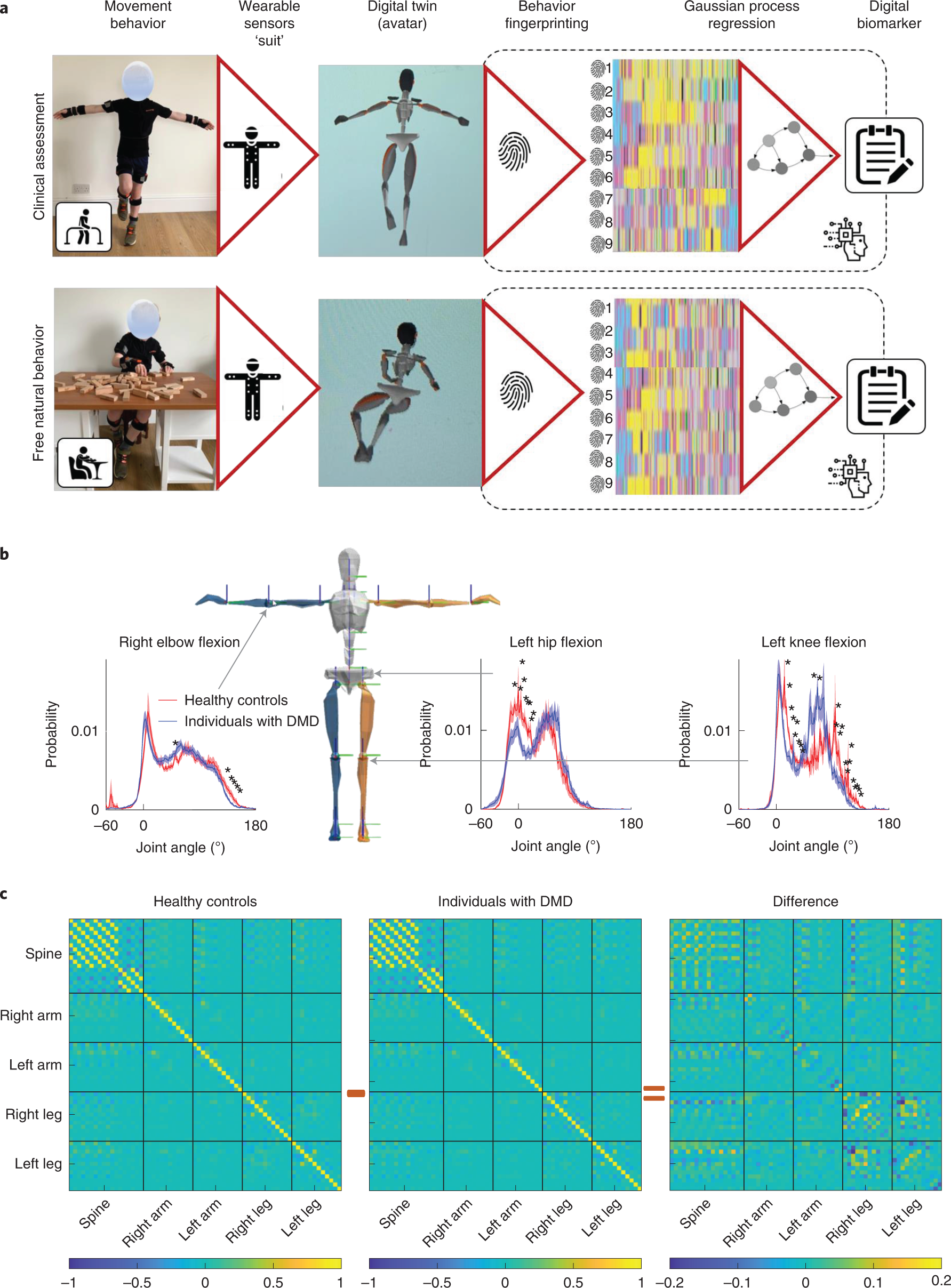 Wearable full-body motion tracking of activities of daily living predicts  disease trajectory in Duchenne muscular dystrophy | Nature Medicine