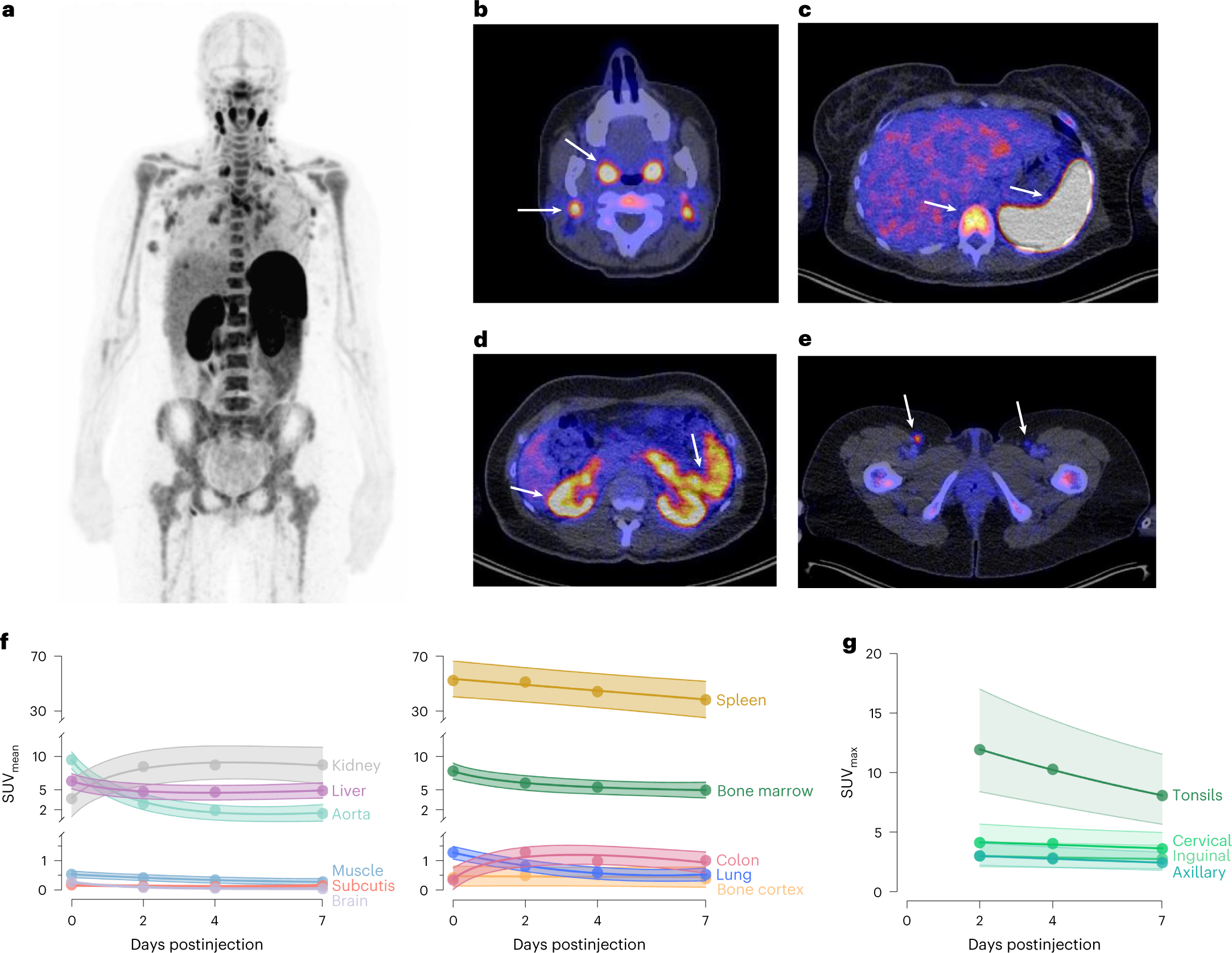Whole-body CD8+ T cell visualization before and during cancer  immunotherapy: a phase 1/2 trial | Nature Medicine