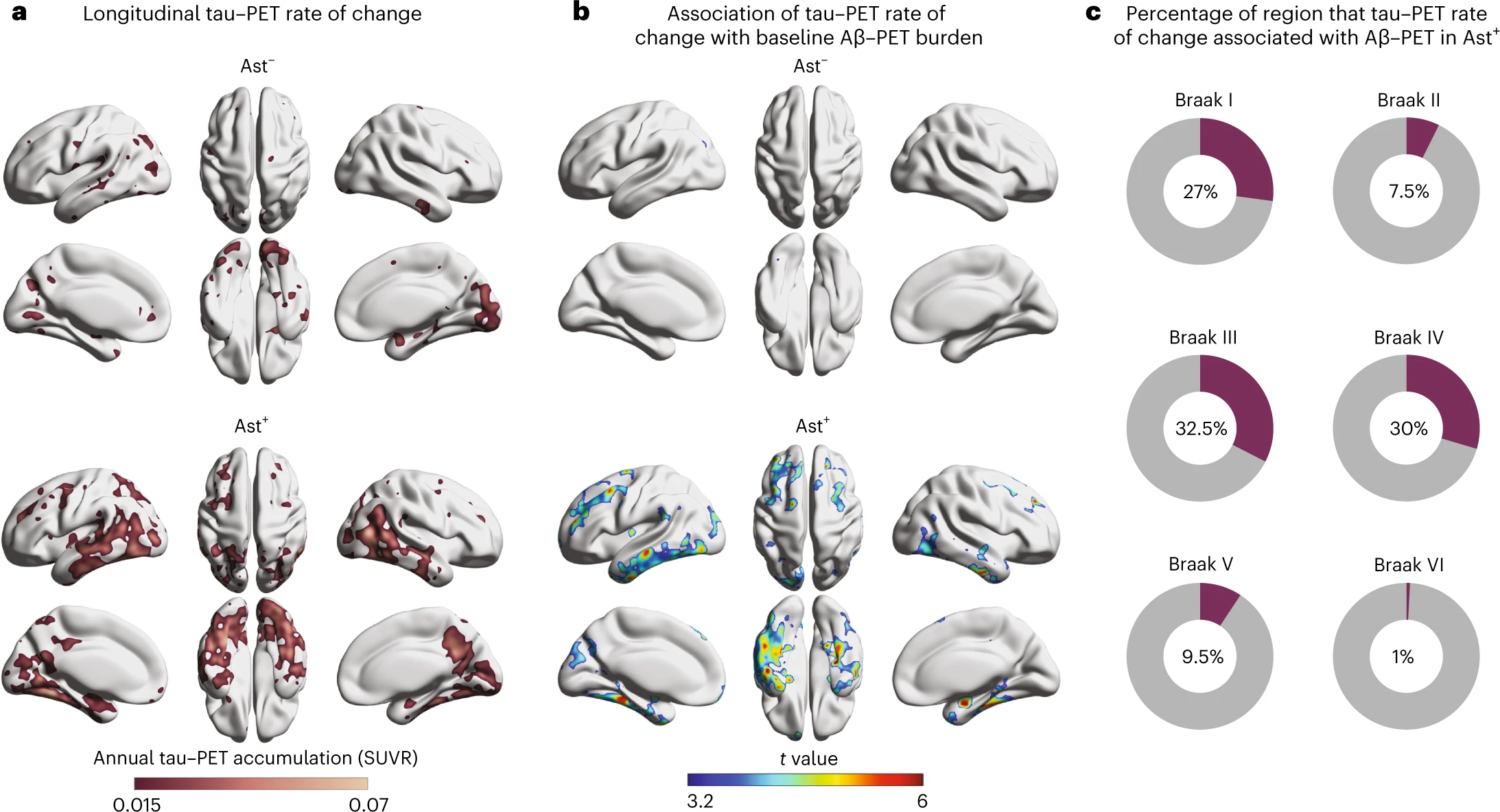 New Blood Biomarker Can Predict If Cognitively Healthy Elderly Will Develop Alzheimer’s Disease