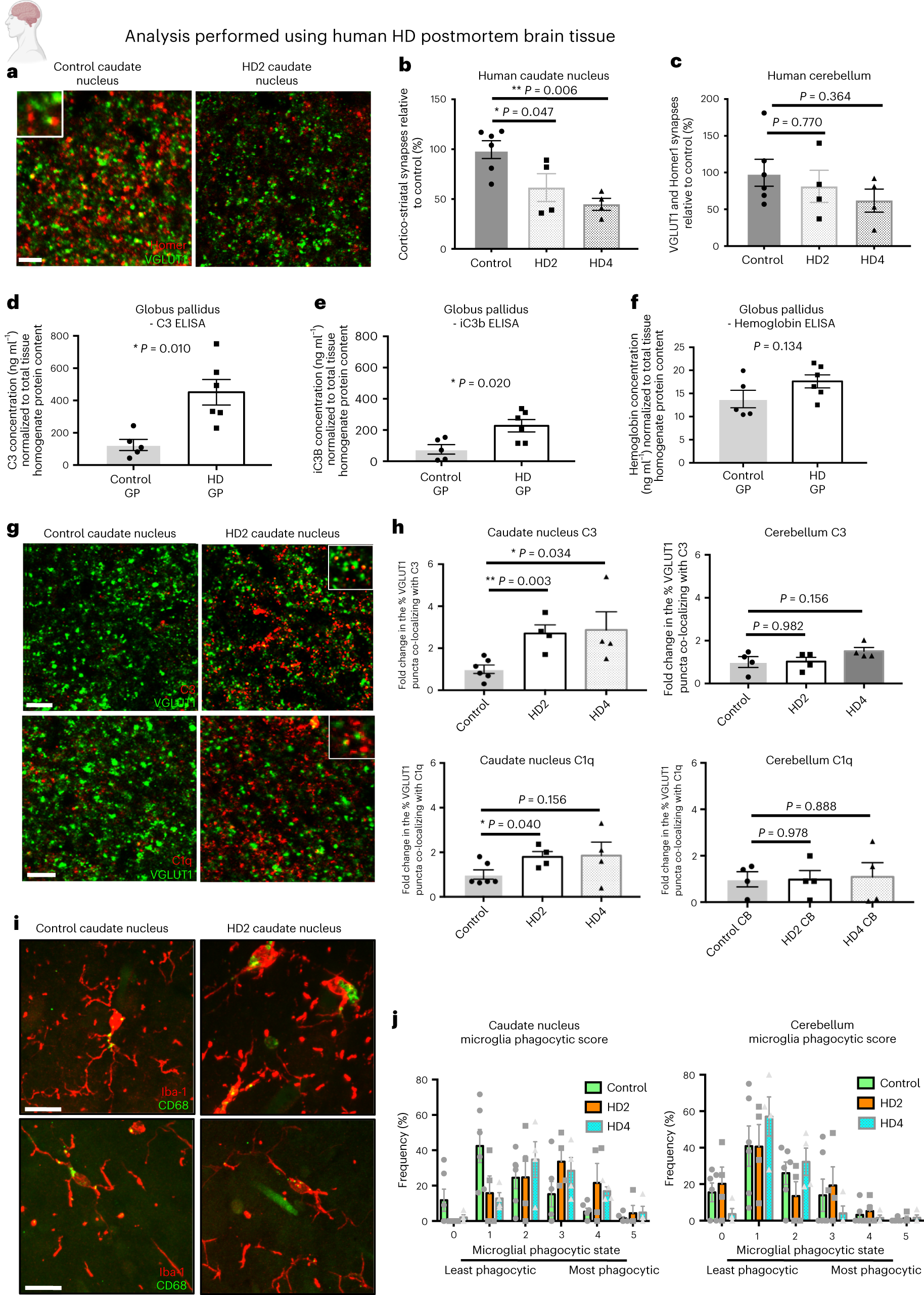 Microglia and complement mediate early corticostriatal synapse