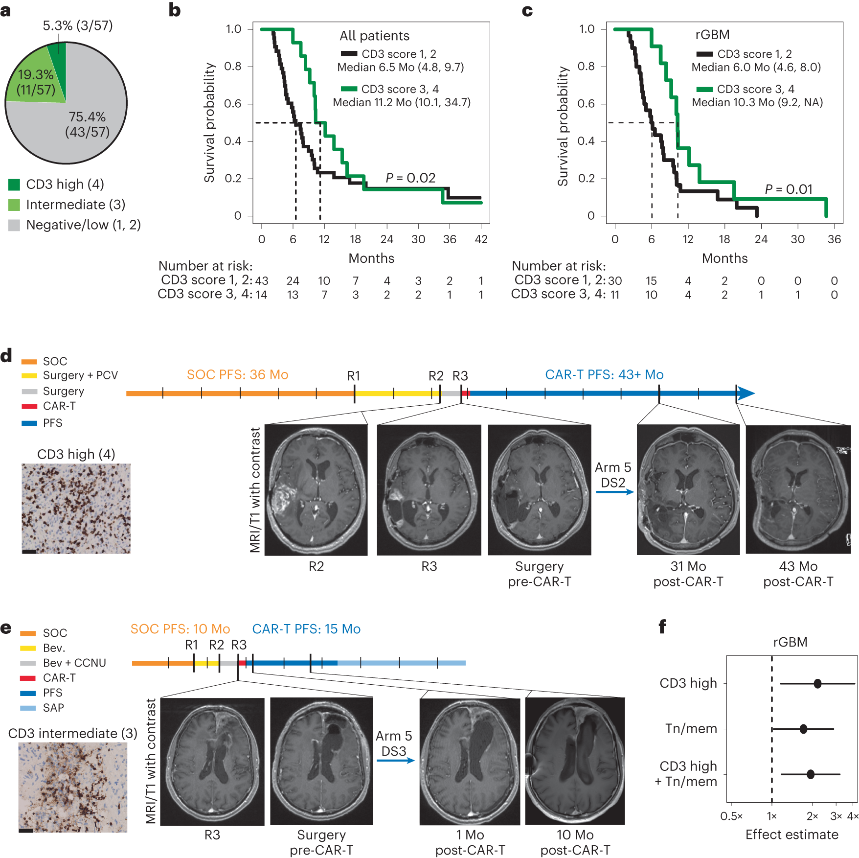 Fig. 4: Pretreatment tumor T cell infiltrates and responses to CAR-T therapy.