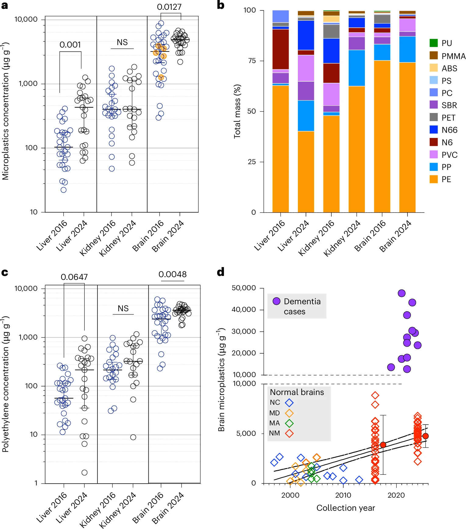 Concentraciones de microplásticos en muestras humanas de hígado, riñón y cerebro de fallecidos.Fuente: www.nature.com