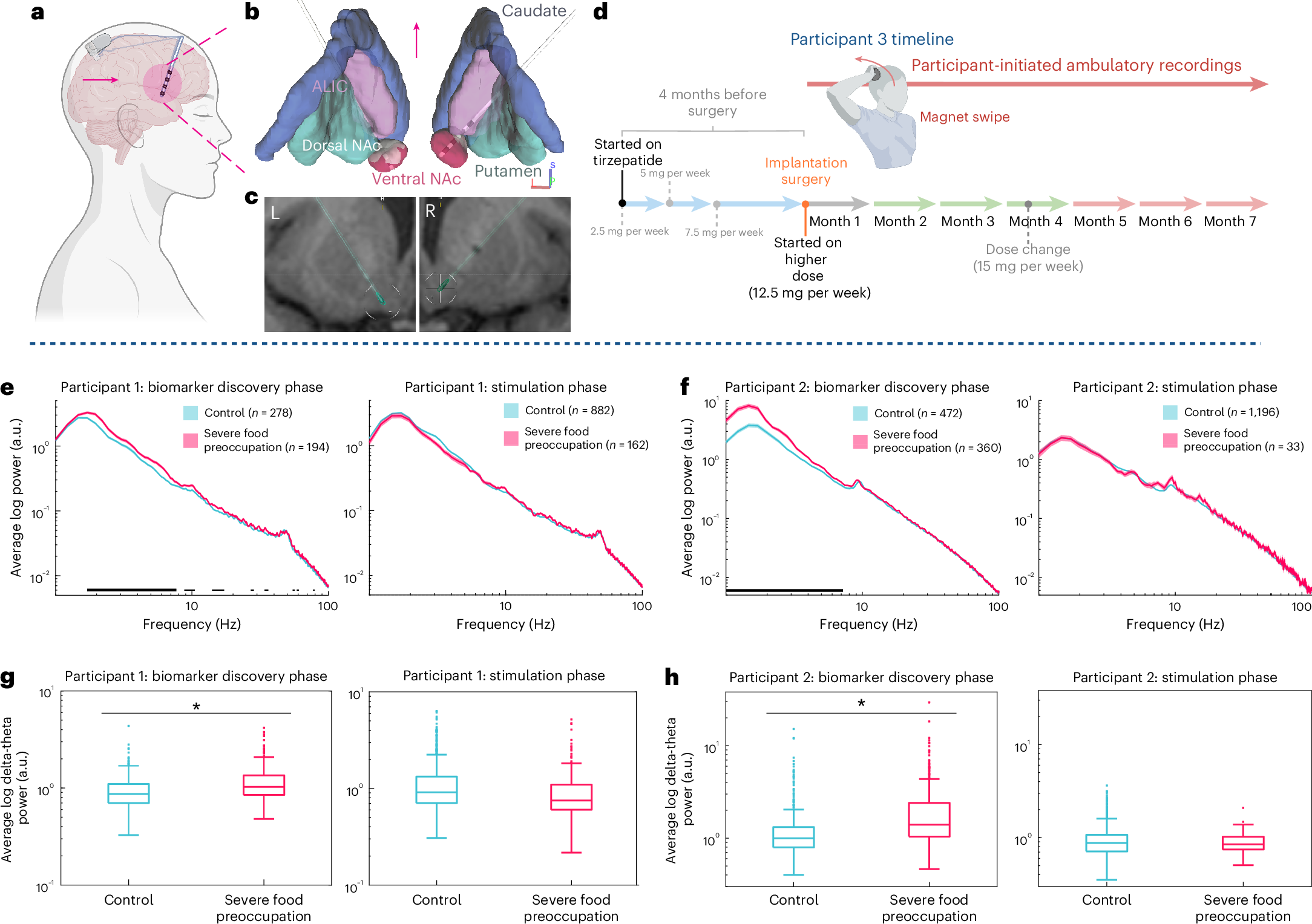 how does tirzepatide affect the brain Brain activity associated with breakthrough food preoccupation in an  individual on tirzepatide