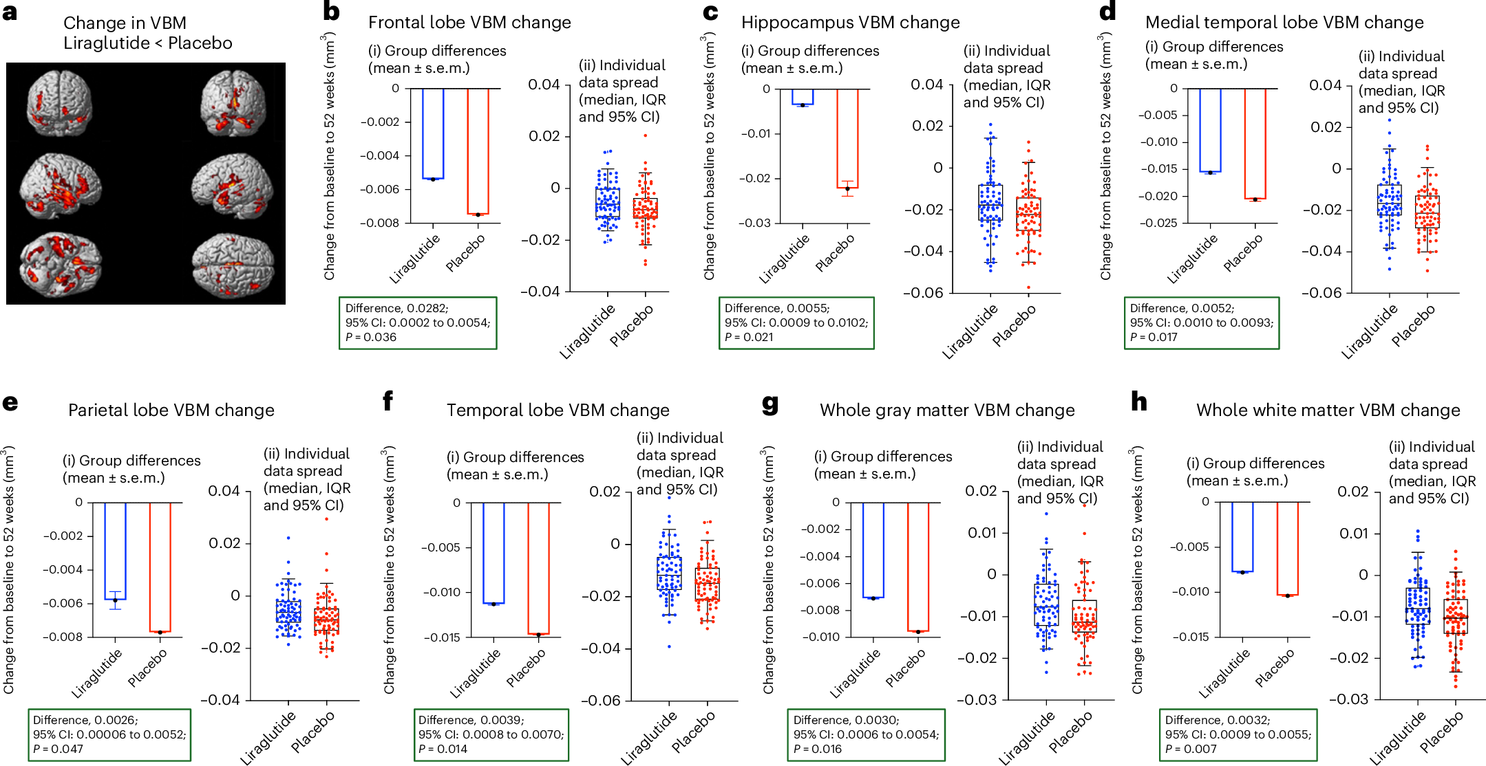 Fig. 5: Changes in exploratory outcomes—VBM analyses at 52 weeks.