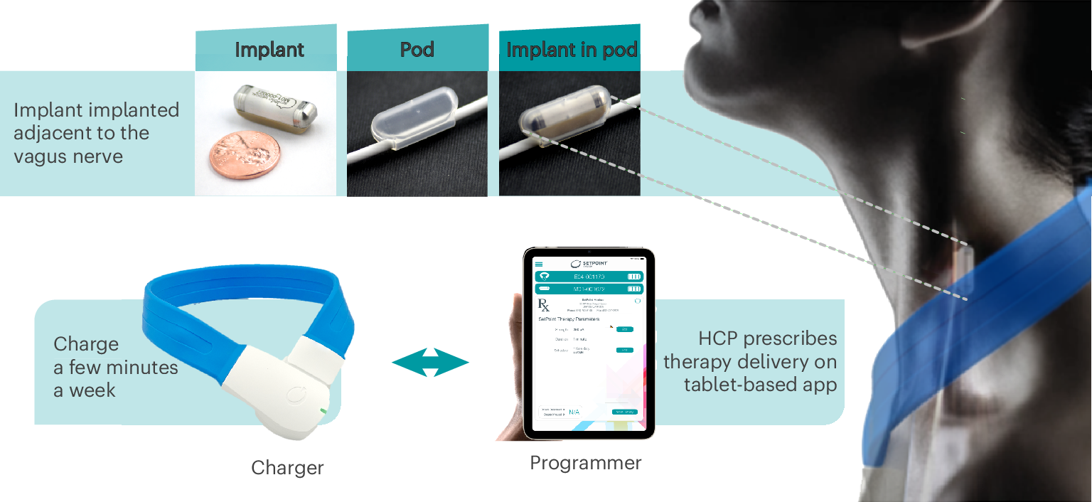 Fig. 2: Integrated neuromodulation system.
