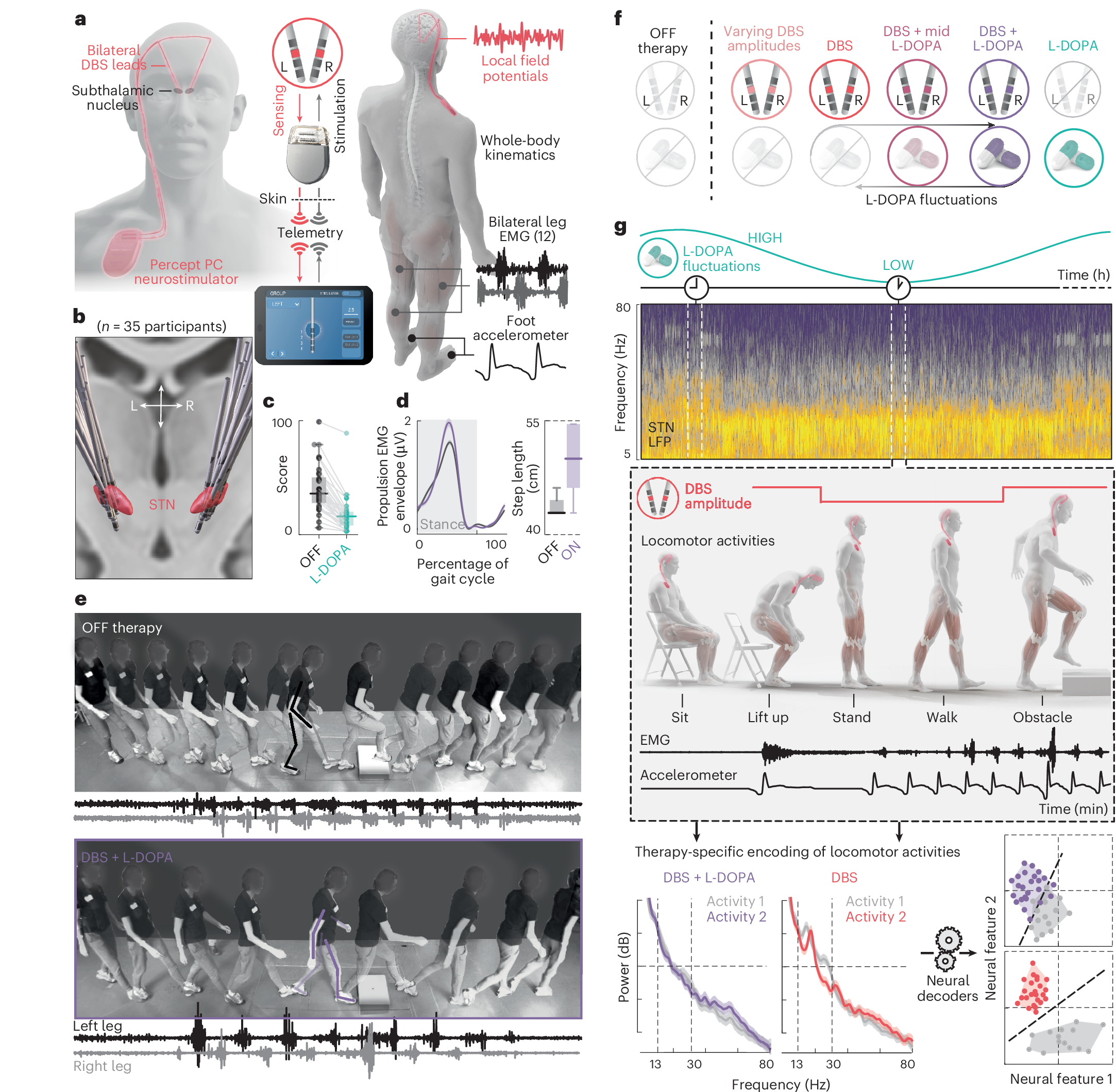 AI支援によるリアルタイム深部脳刺激でパーキンソン病の歩行障害を改善 （When Brain Stimulation Learns to Walk With You）