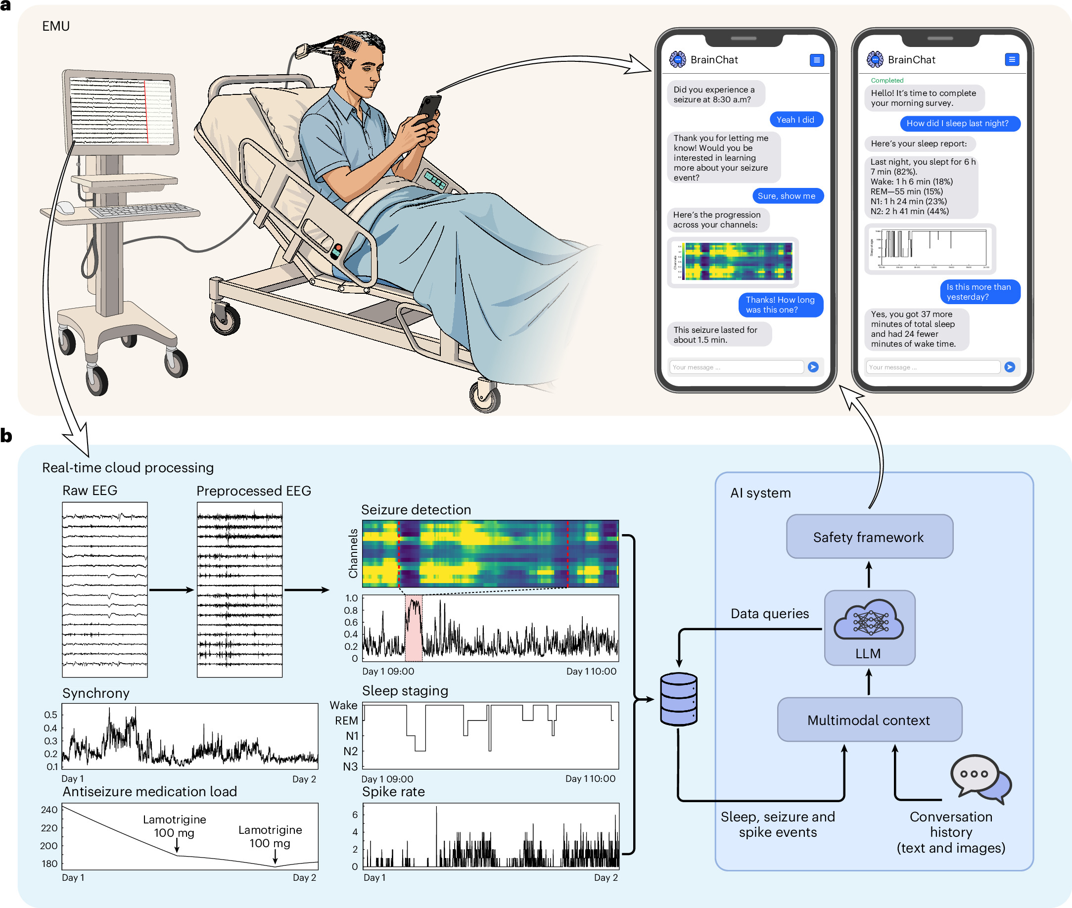 Human–artificial intelligence collaboration for comanaging epilepsy in real time